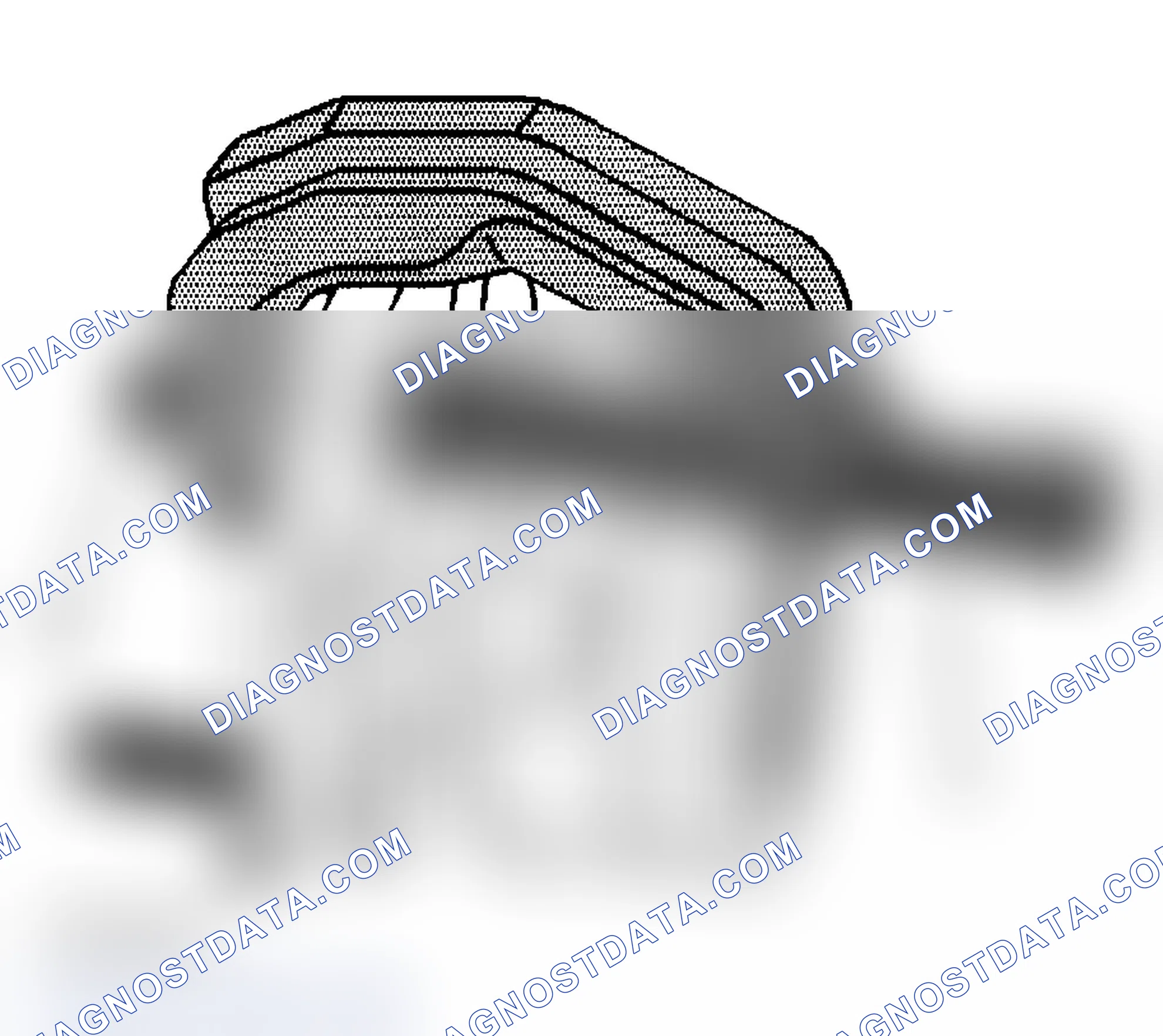Scheme 139: Installation Procedure