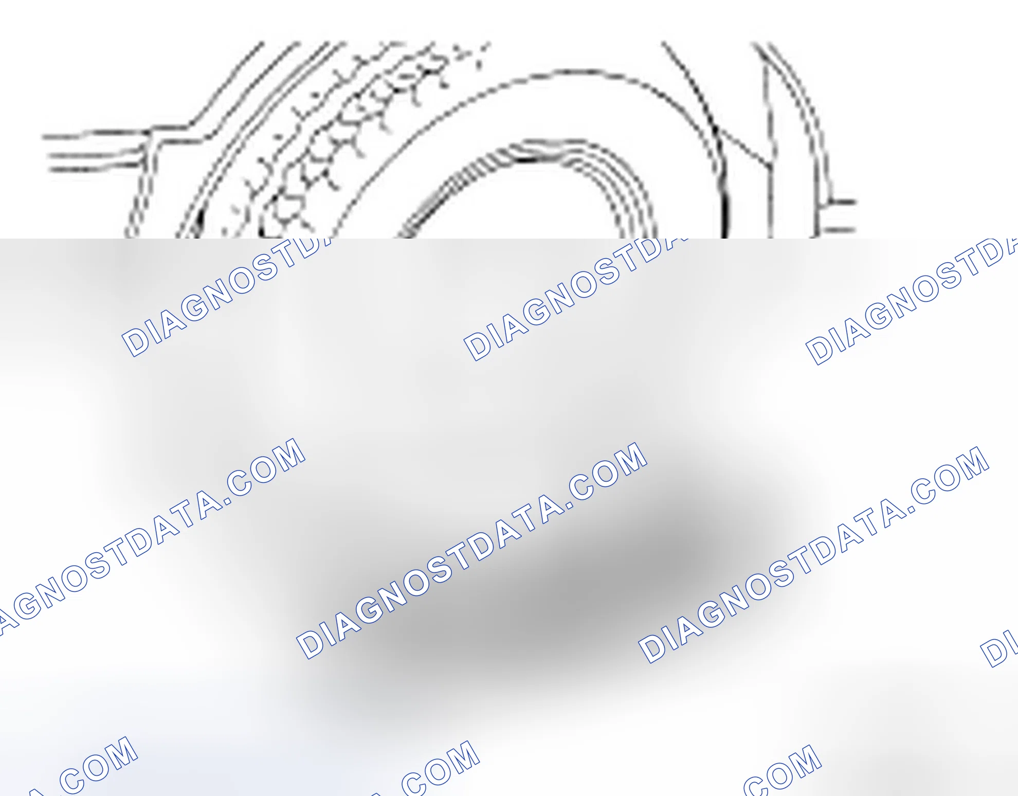 Scheme 22: FRONT WHEEL TURNING ANGLE