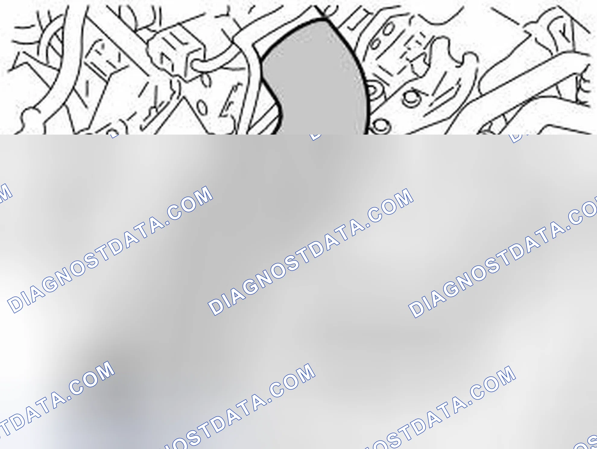 Scheme 245: Remove The EGR Components
