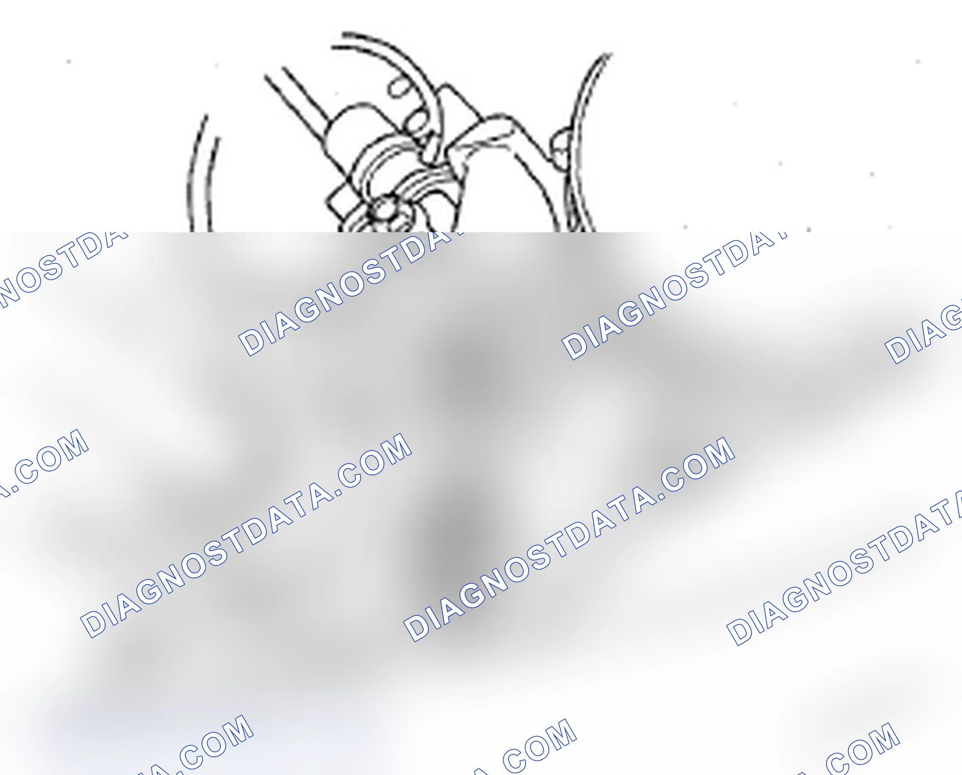Scheme 17: Oil Filter Feed Pipe Replacement