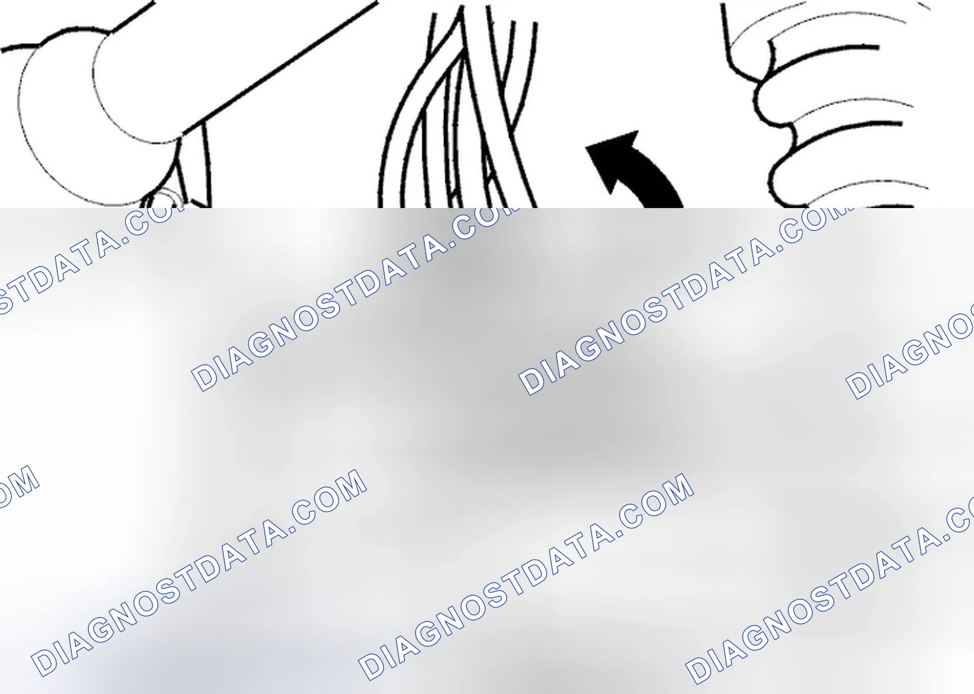 Scheme 333: Removing front bracket