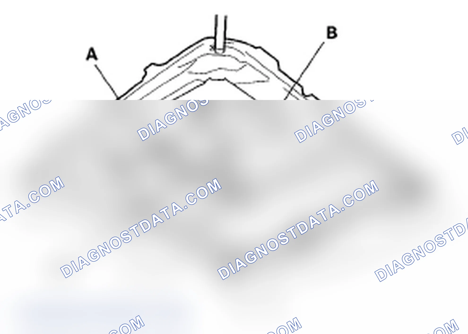 Scheme 30: Closing Force and Opening Drag Check