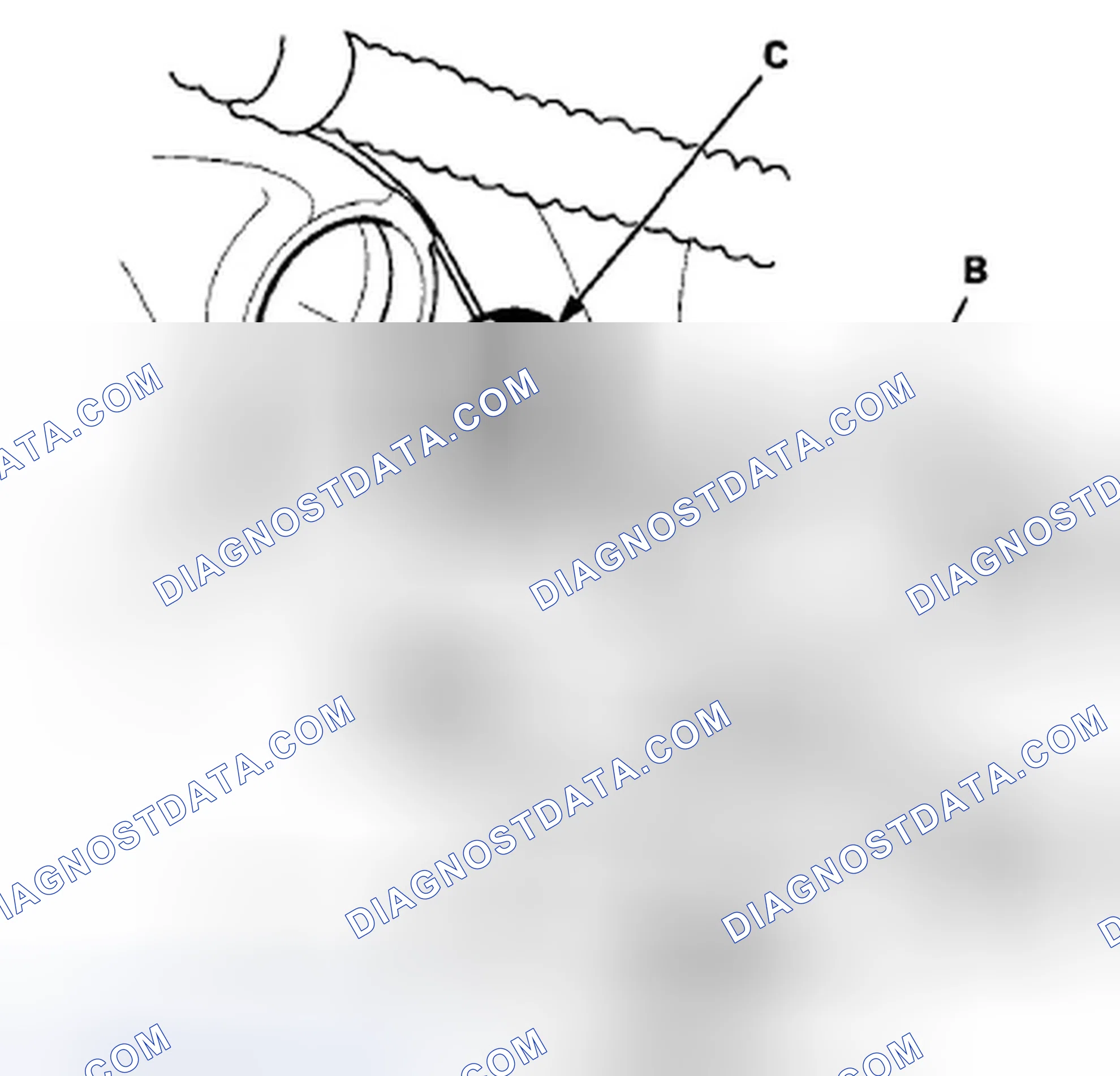 Scheme 208: CMP Sensor B Replacement