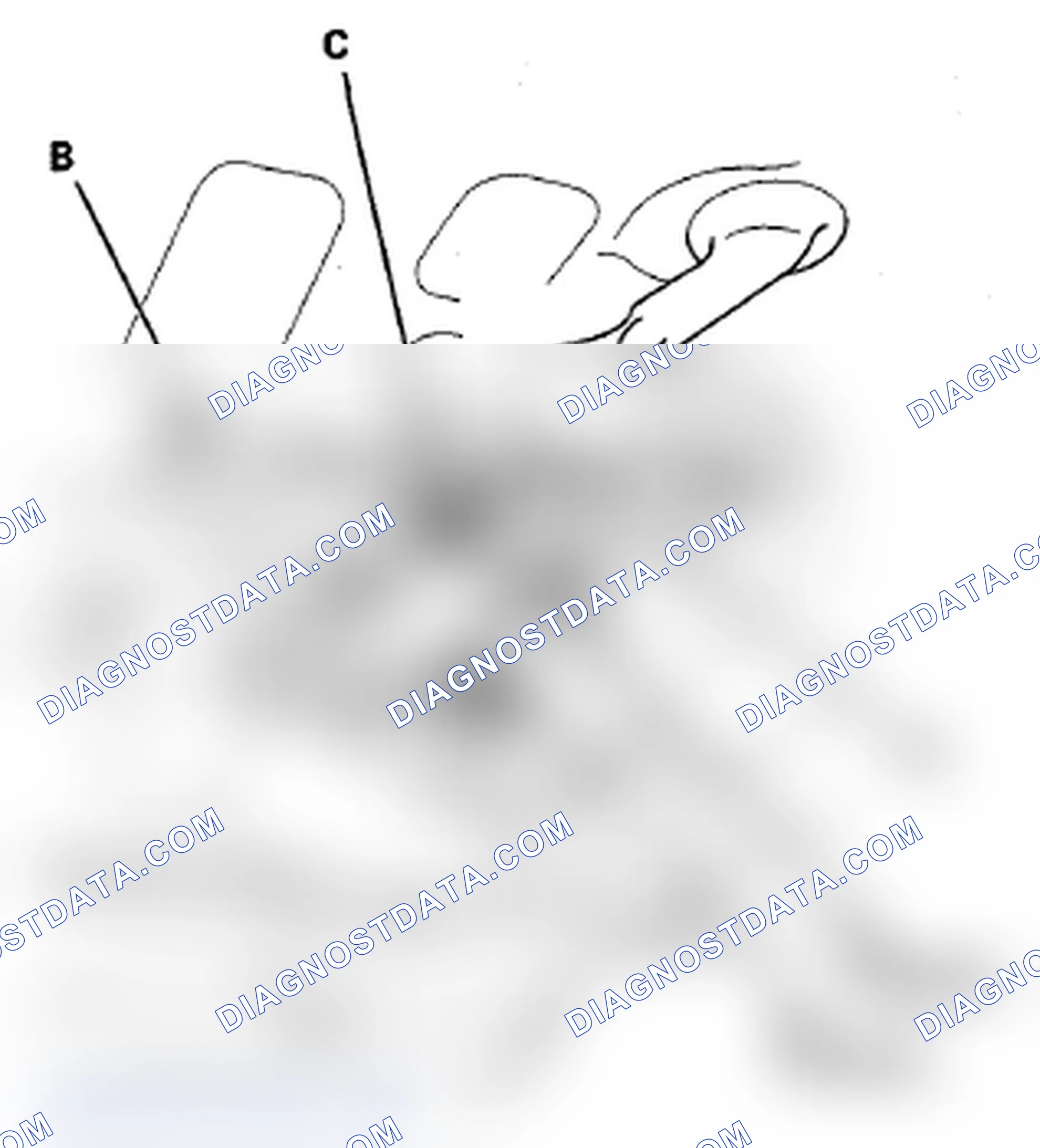 Scheme 57: FTP Sensor Replacement