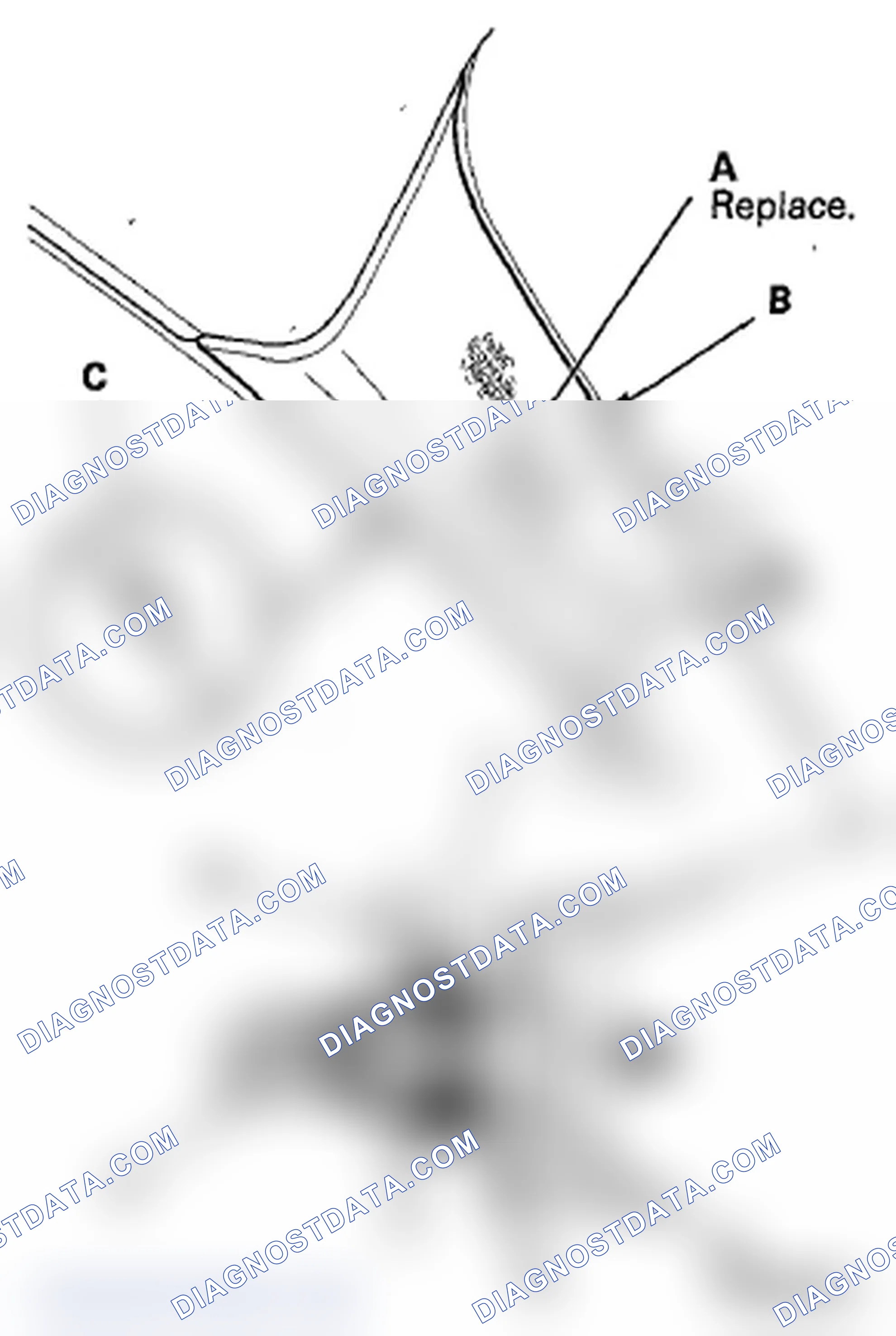 Scheme 171: A-Pillar Trim