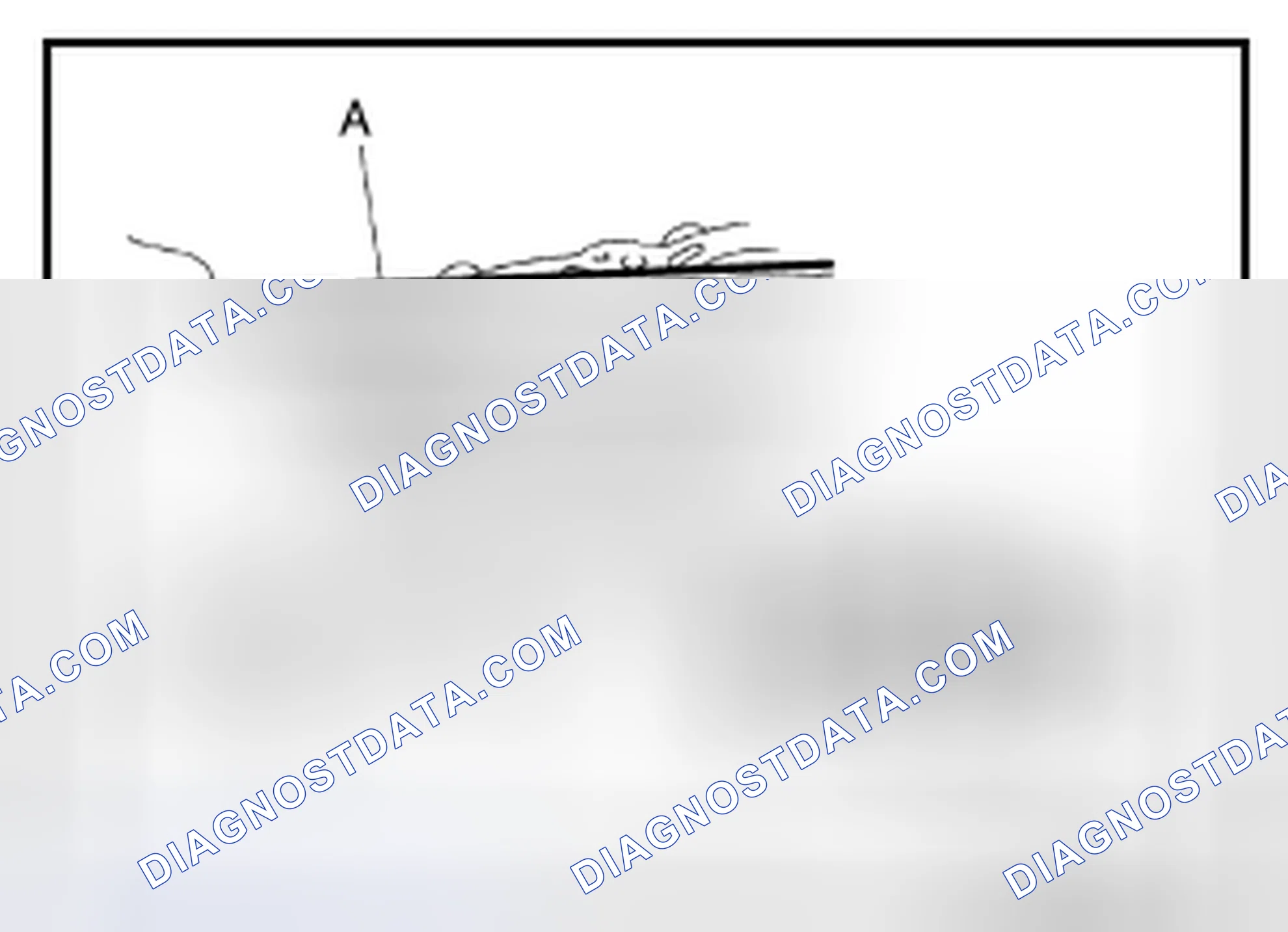 Scheme 260: CYLINDER BLOCK DISTORTION