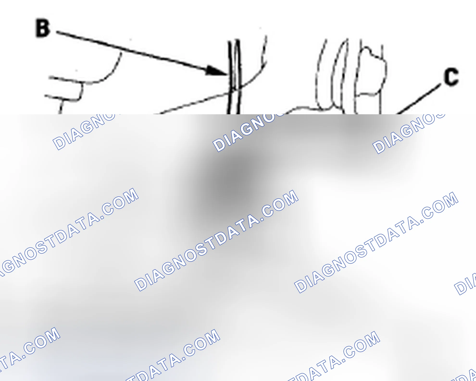 Scheme 39: Brake Hose Replacement