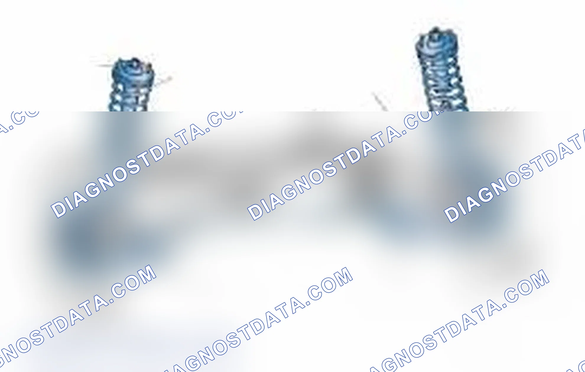 Scheme 25: Typical Front Suspension & Steering Components
