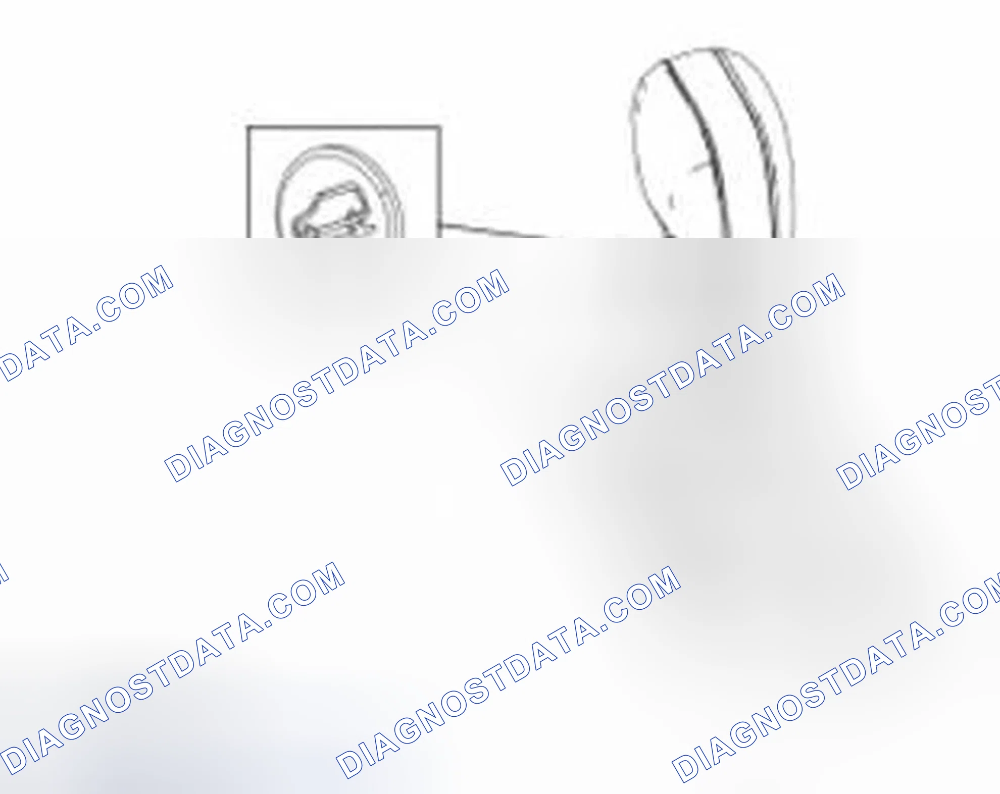 Scheme 299: Drive with Grade Assist
