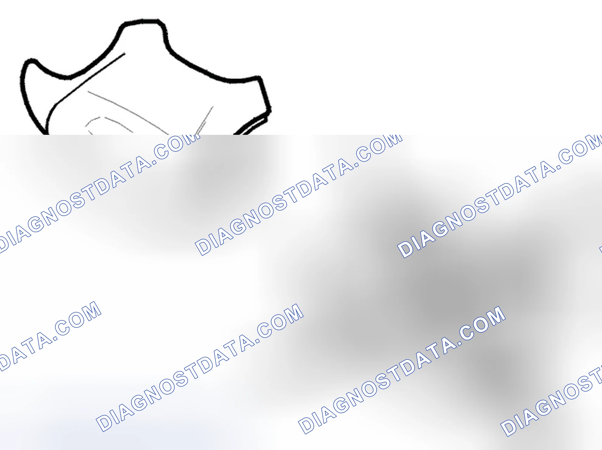 Scheme 160: Placing The Steering Wheel Module