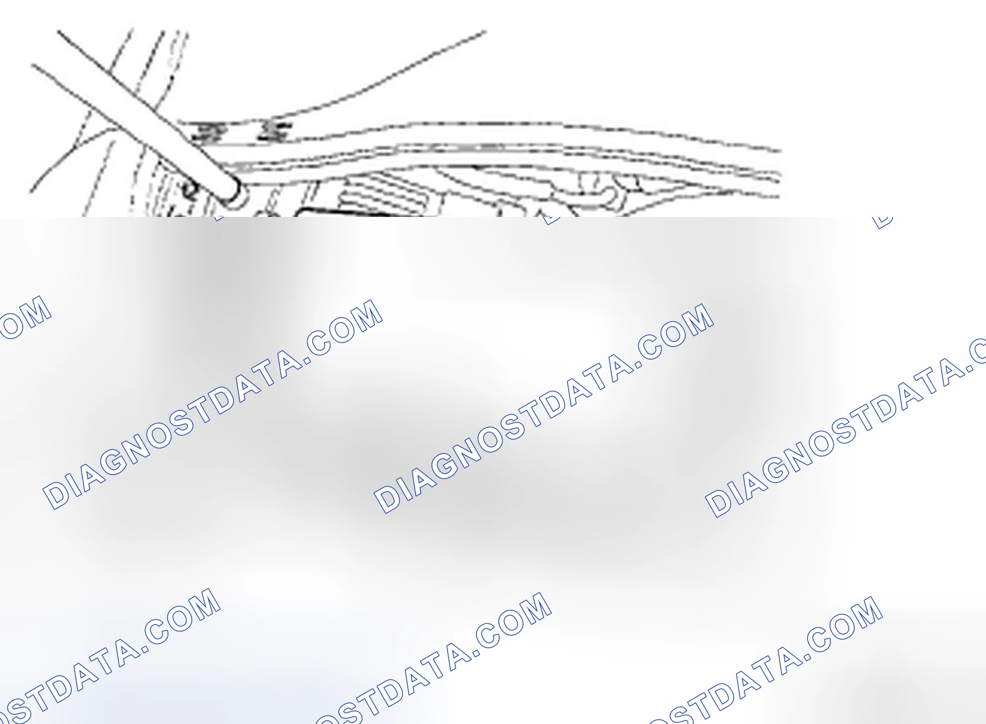 Scheme 73: REPLACEMENT