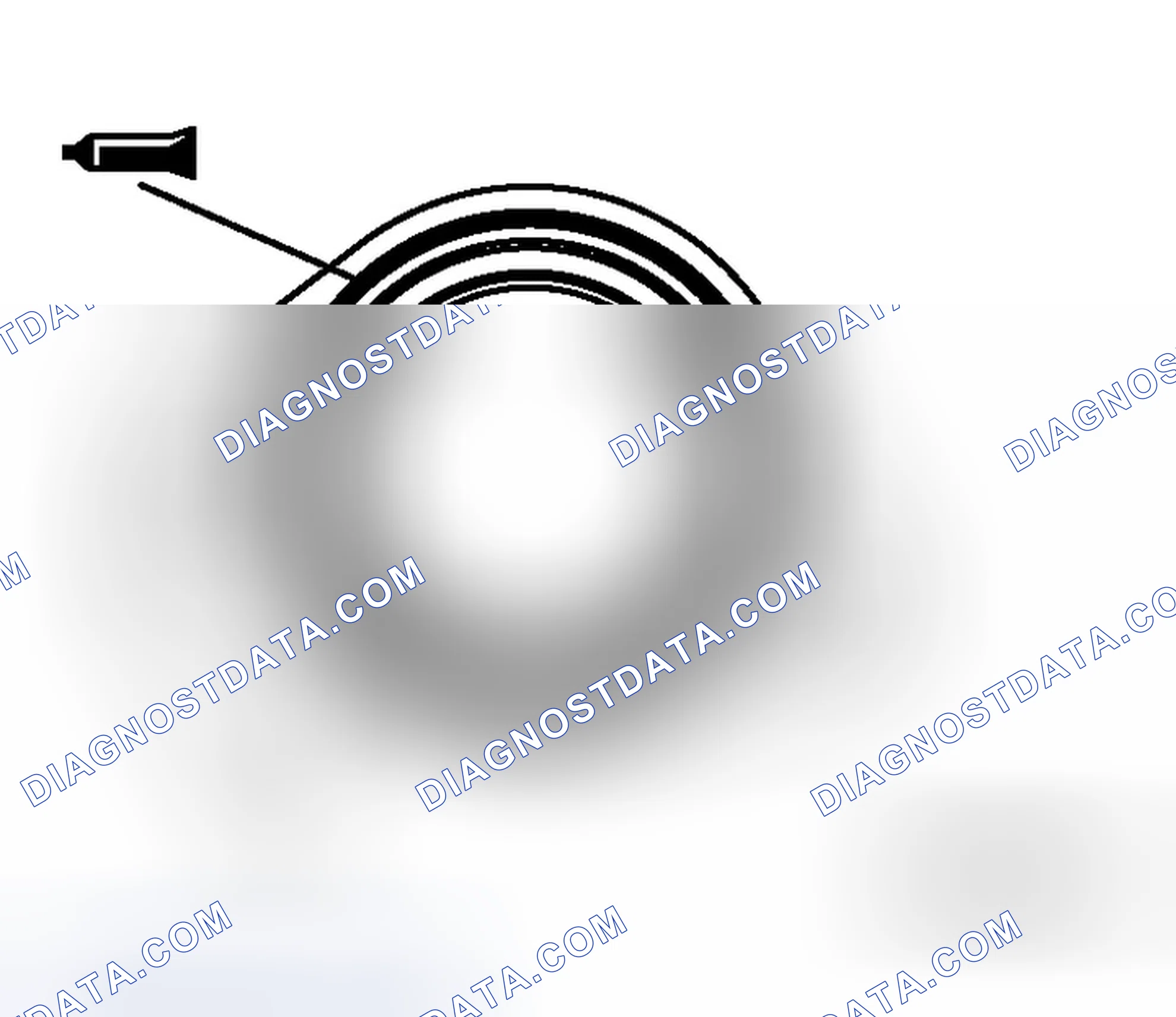 Scheme 302: >> B << CAMSHAFT POSITION SENSOR SUPPORT INSTALLATION