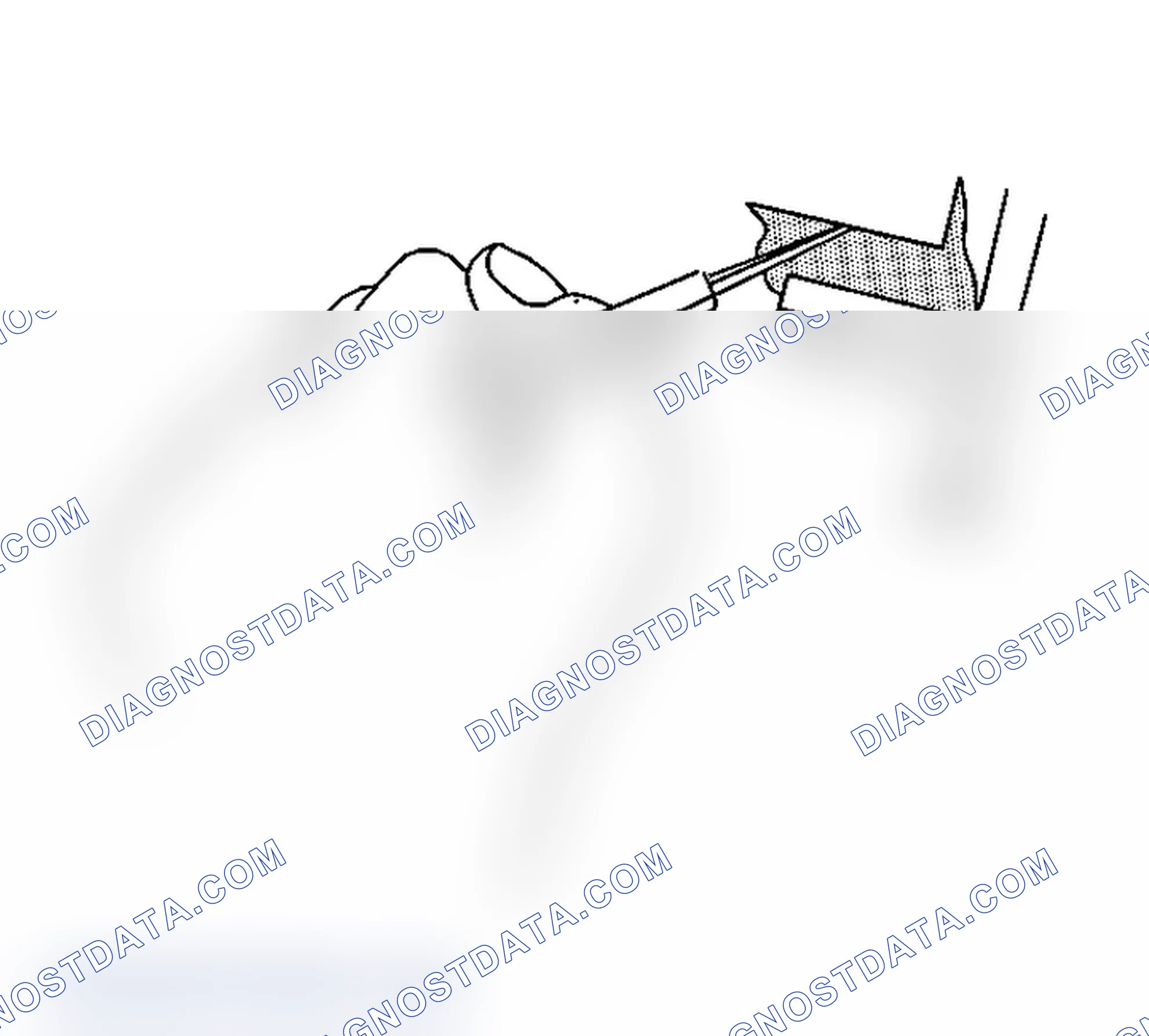 Scheme 66: Body Waterleak Repair