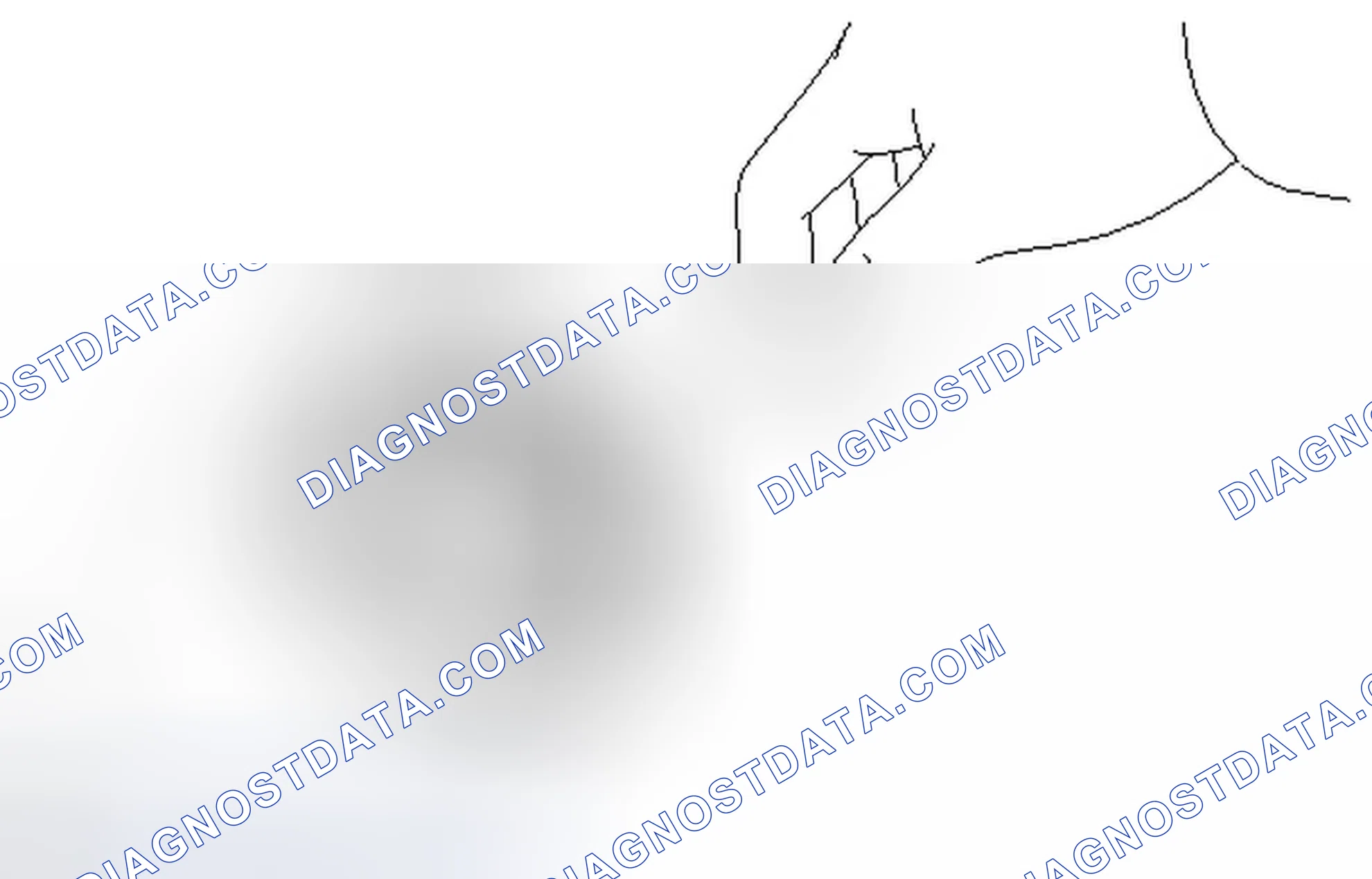Scheme 88: REASSEMBLY
