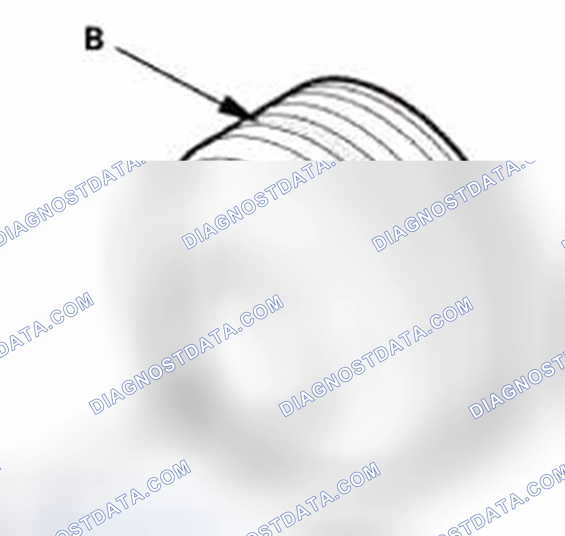 Scheme 5
