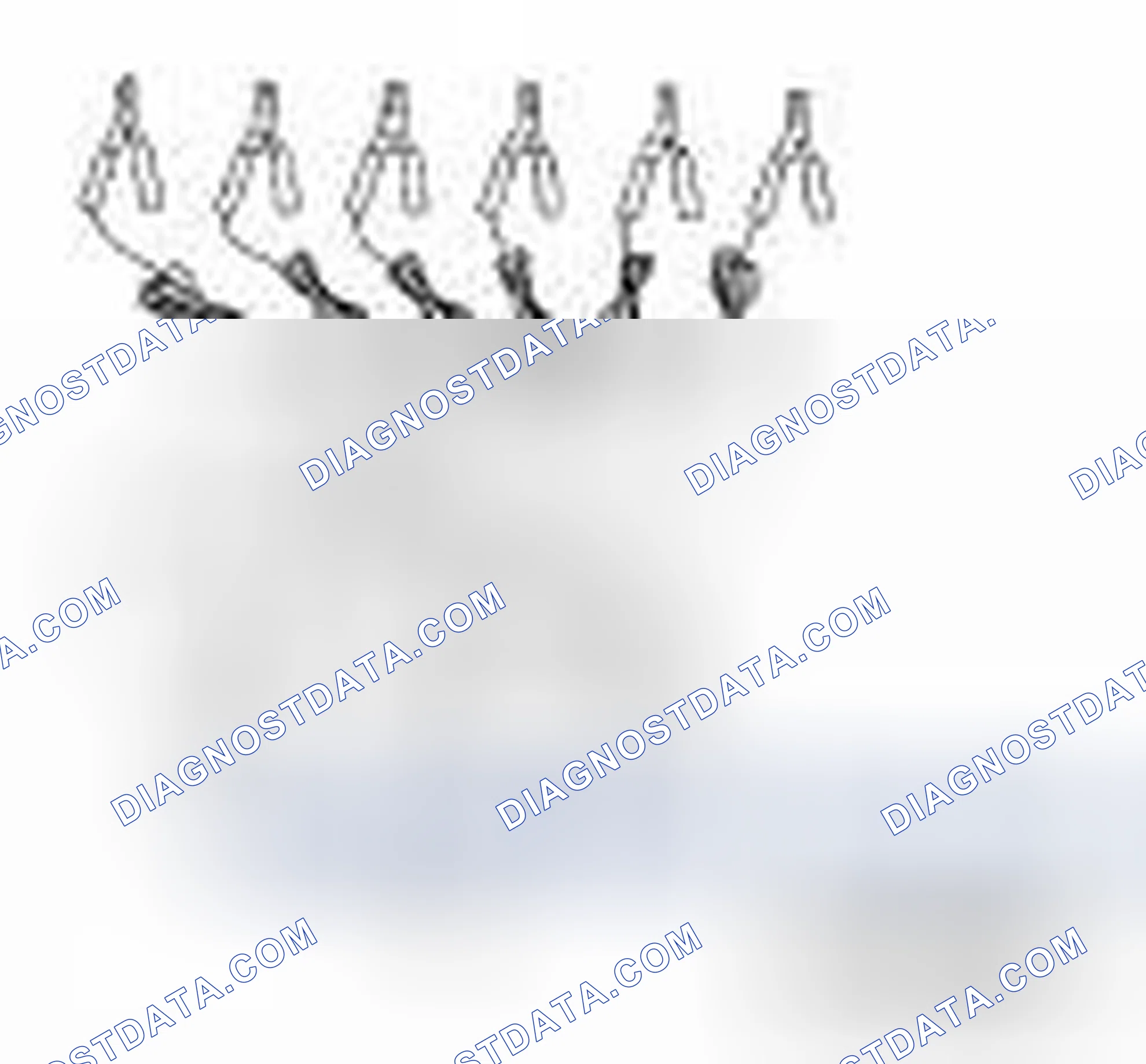 Scheme 132: Special Service Tool