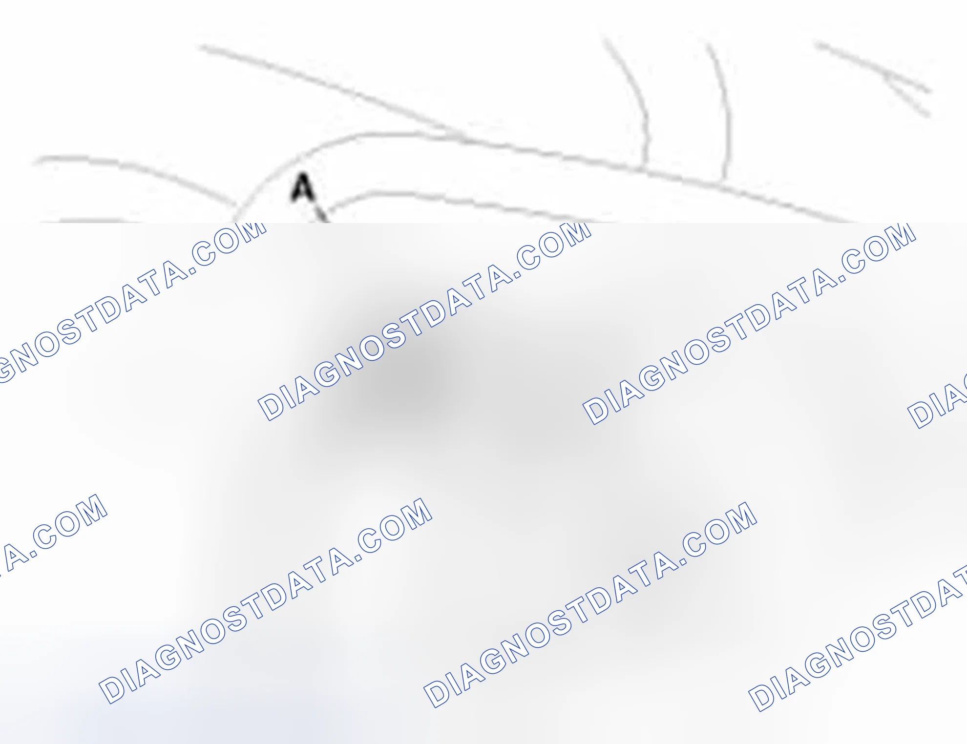 Scheme 238: Removal
