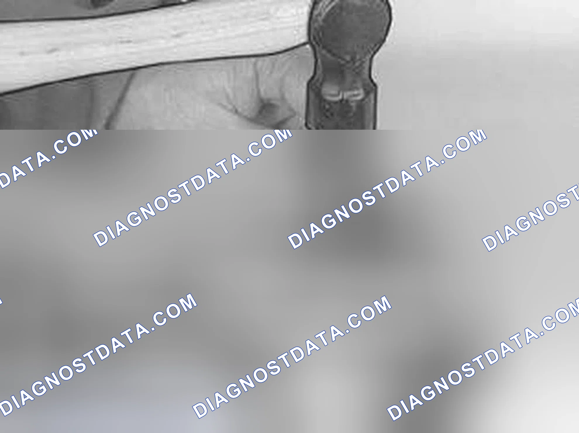 Scheme 422: Marking connecting rod (where applicable)