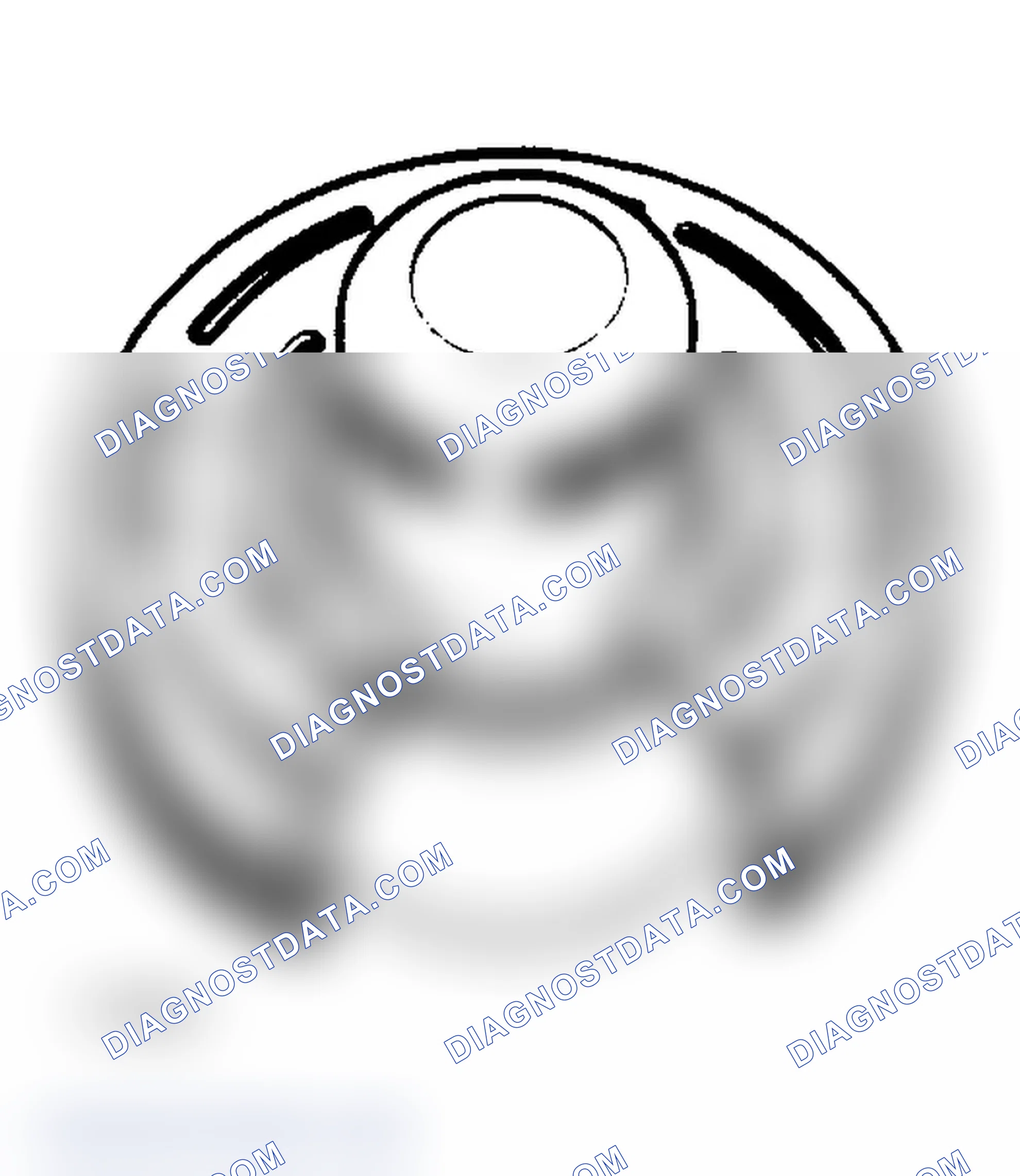 Scheme 29: Remove Bearing