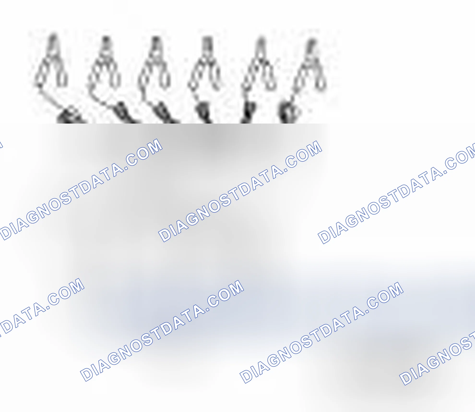 Scheme 87: Special Service Tools