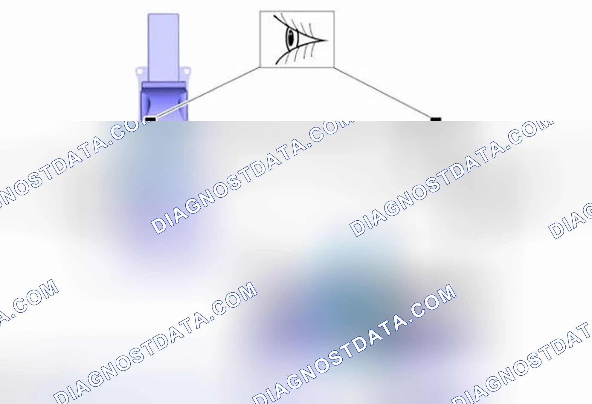 Scheme 31: Installation