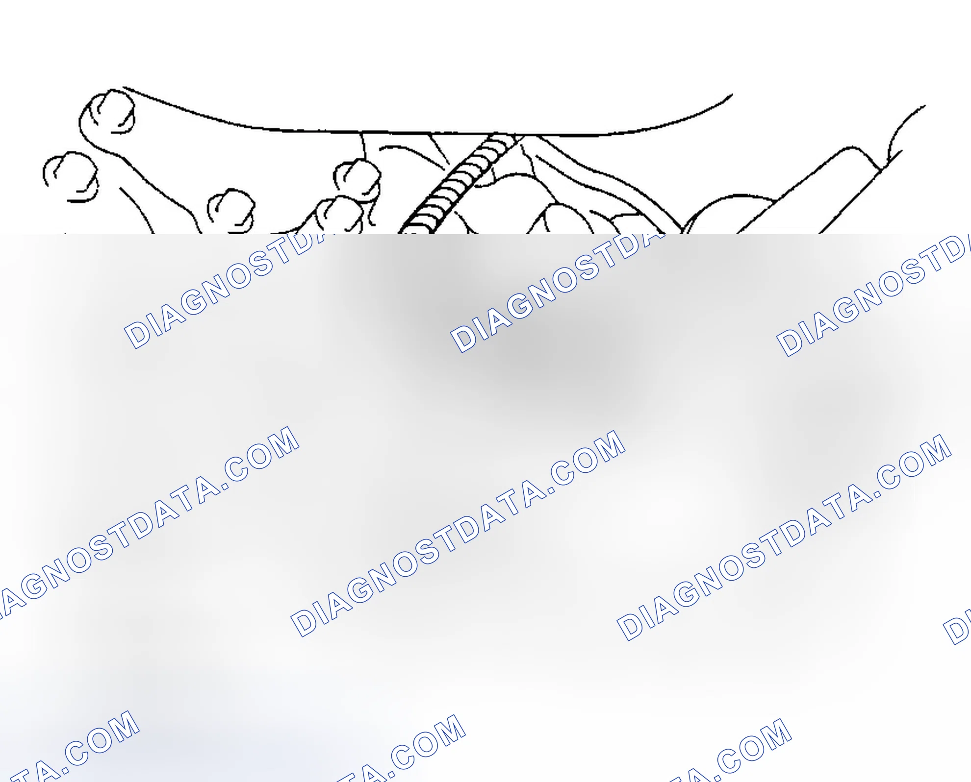 Scheme 139: Removal & Installation