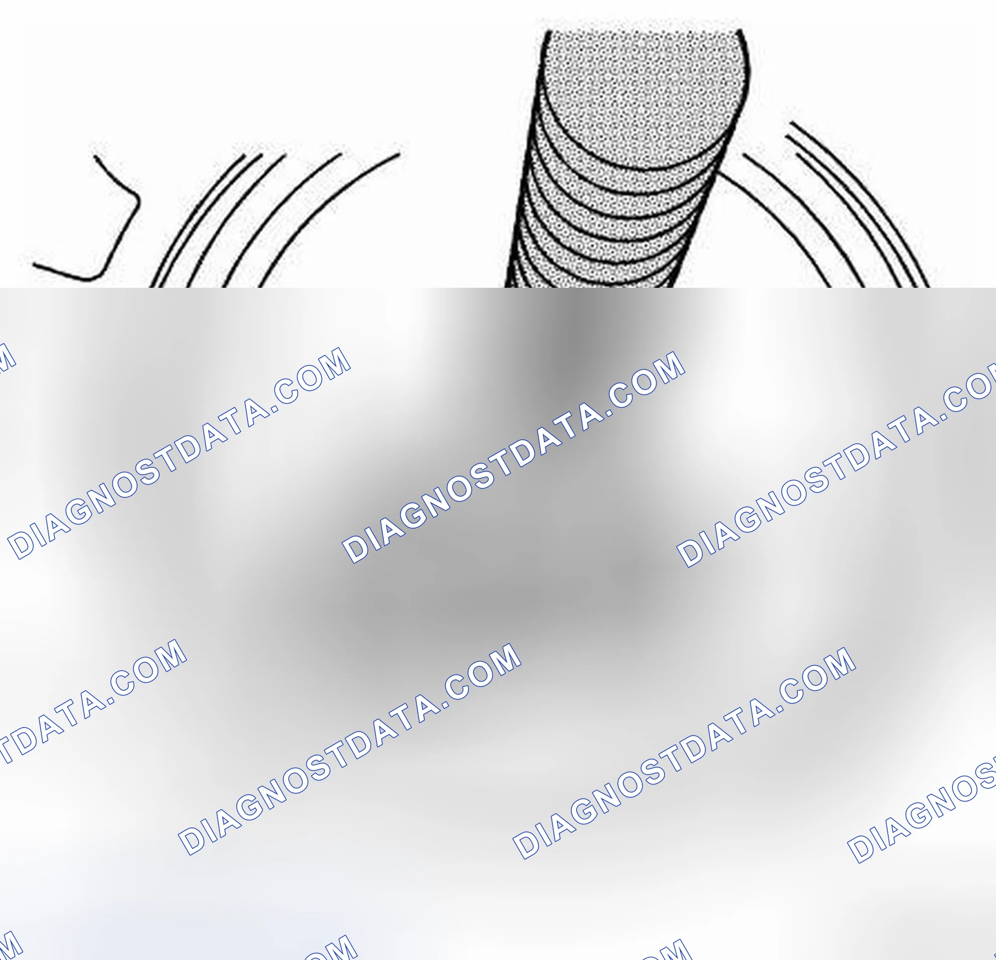 Scheme 156: Cylinder Liner Removal