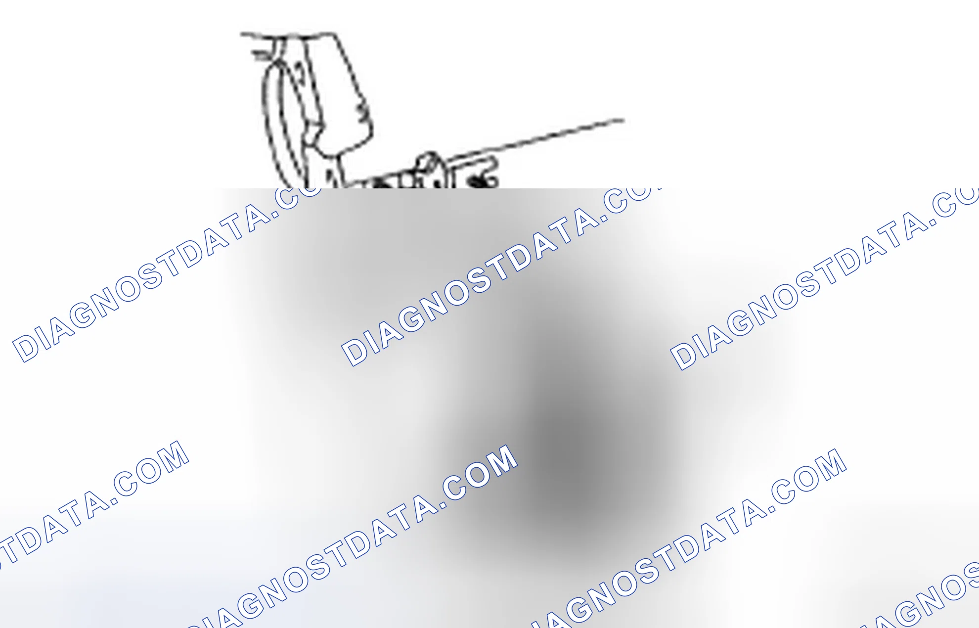Scheme 23: REMOVAL