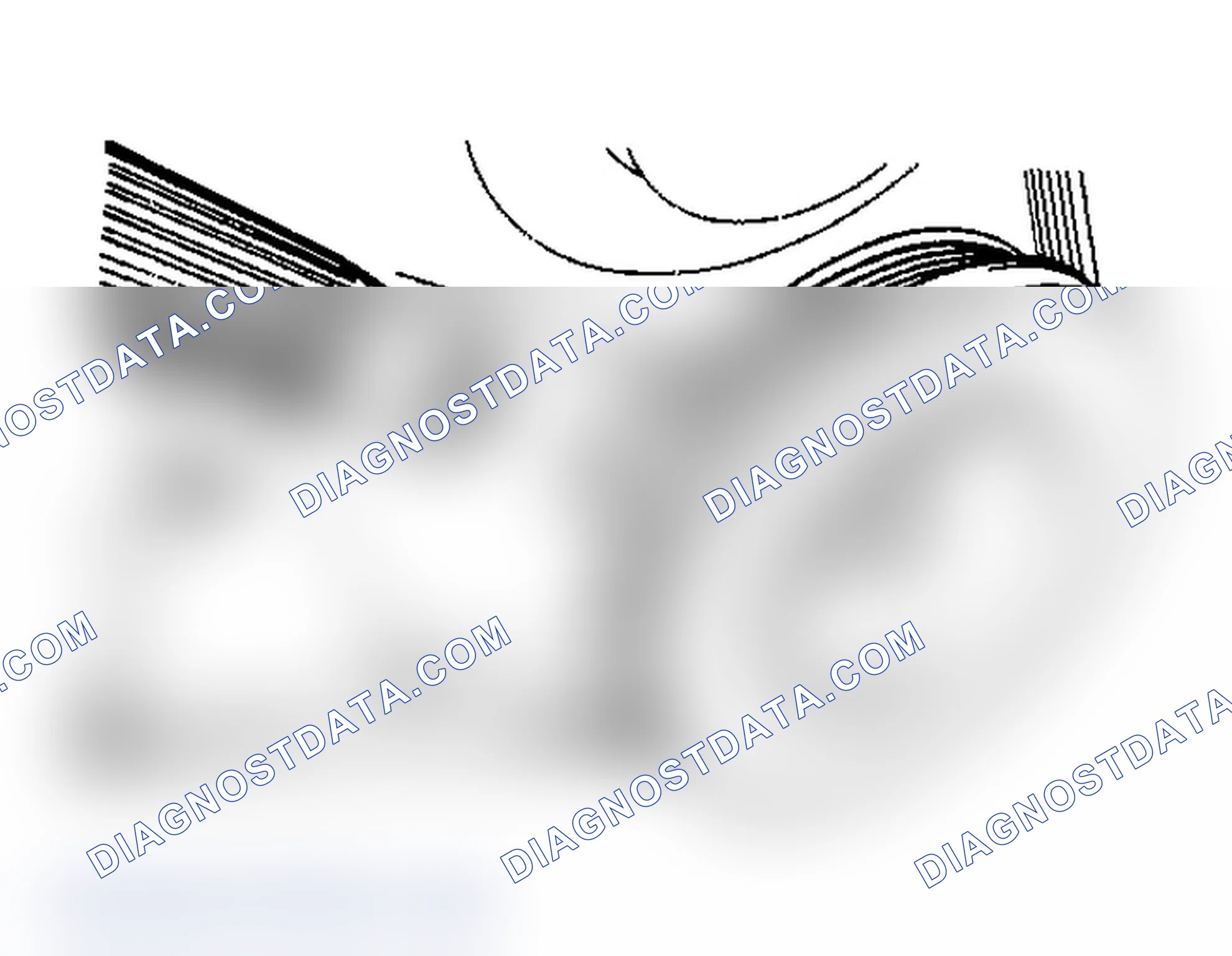Scheme 4: Ignition Timing Marks (Elantra, Excel & Scoupe)