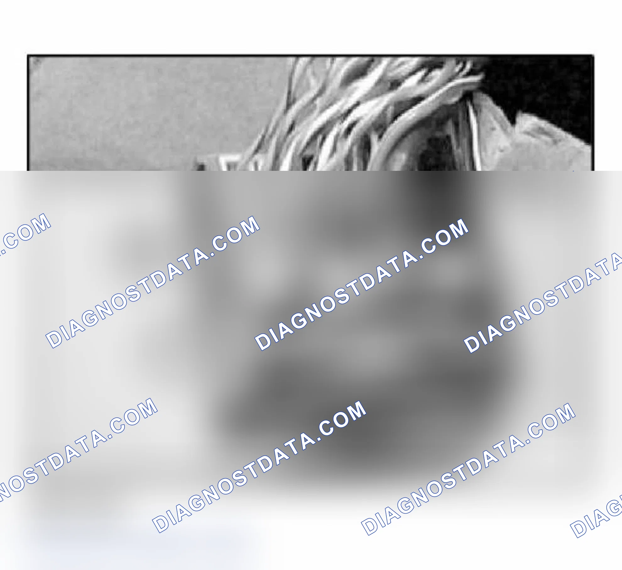 Scheme 84: Removing MQS Contacts From Contact Carrier