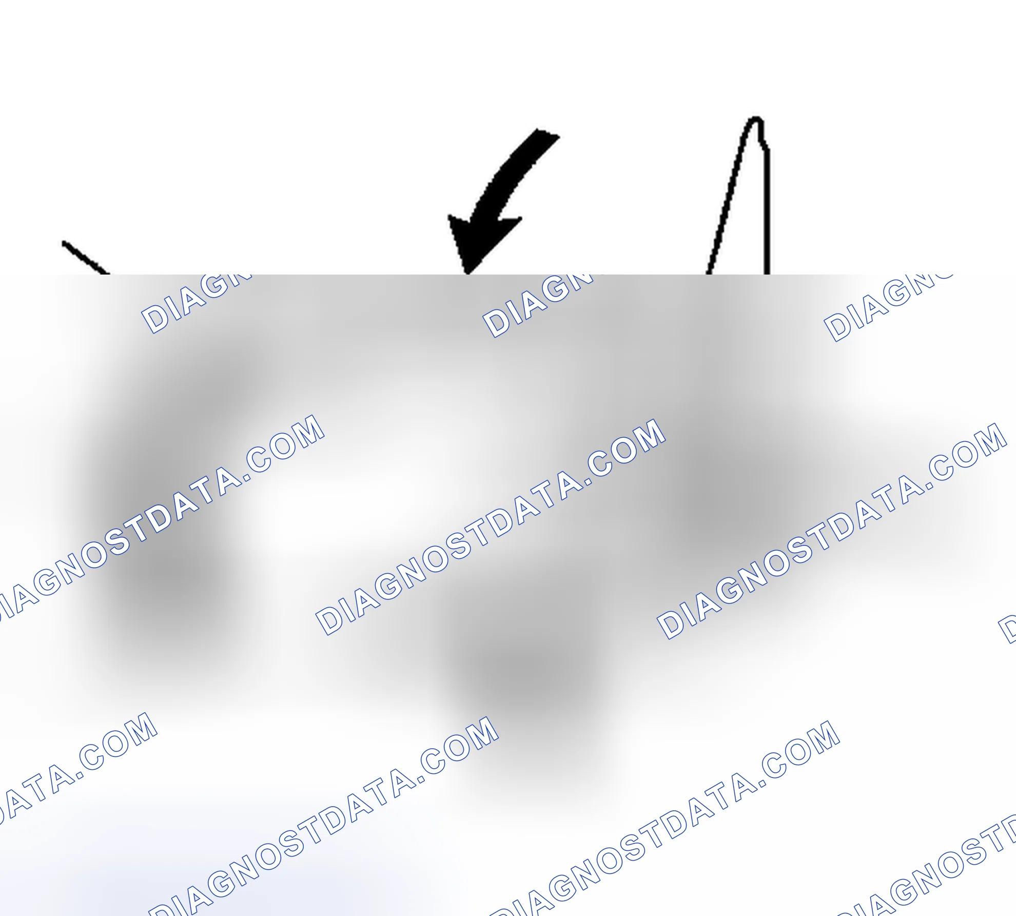 Scheme 12: Installation Procedure