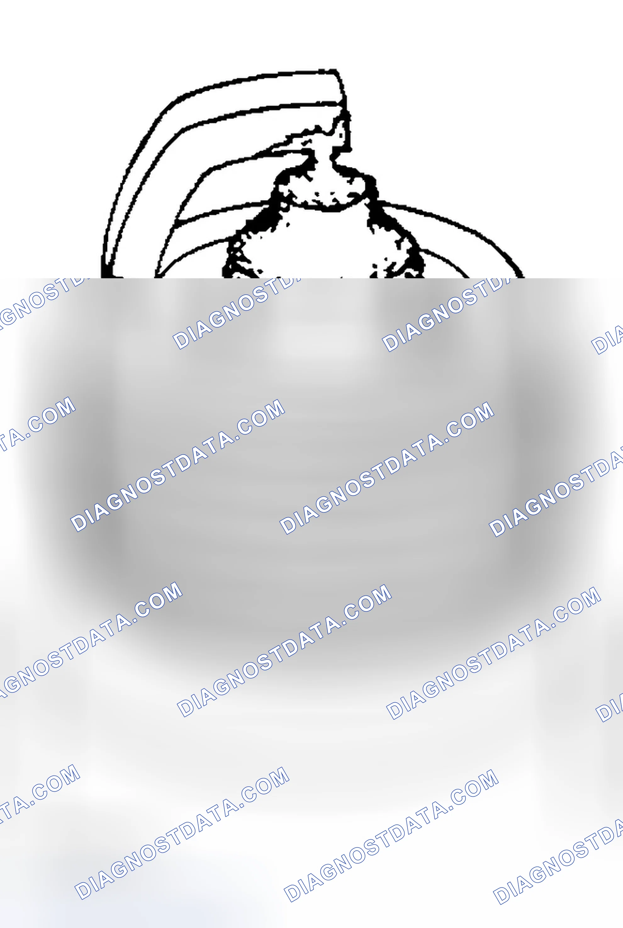 Scheme 81: SPARK PLUG - INSPECTION