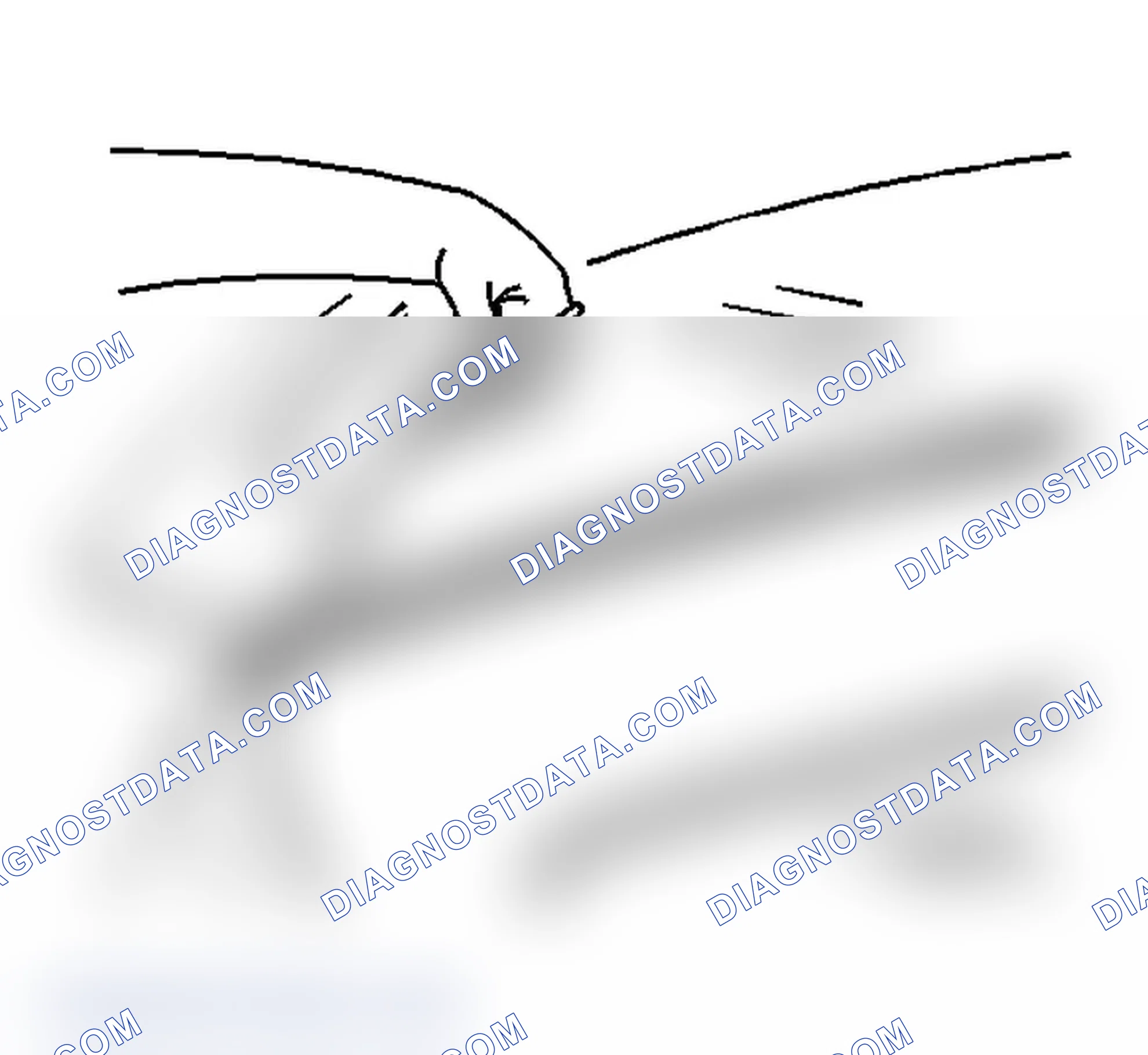 Scheme 21: Removal Procedure