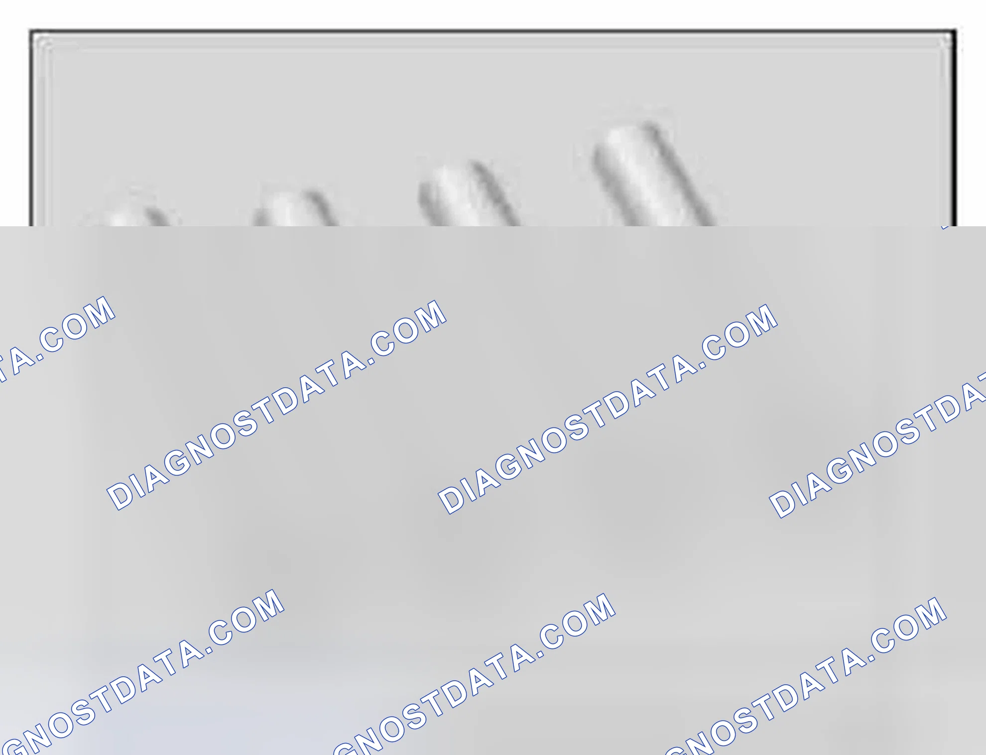 Scheme 793: 11 9 490 Holding Sleeve