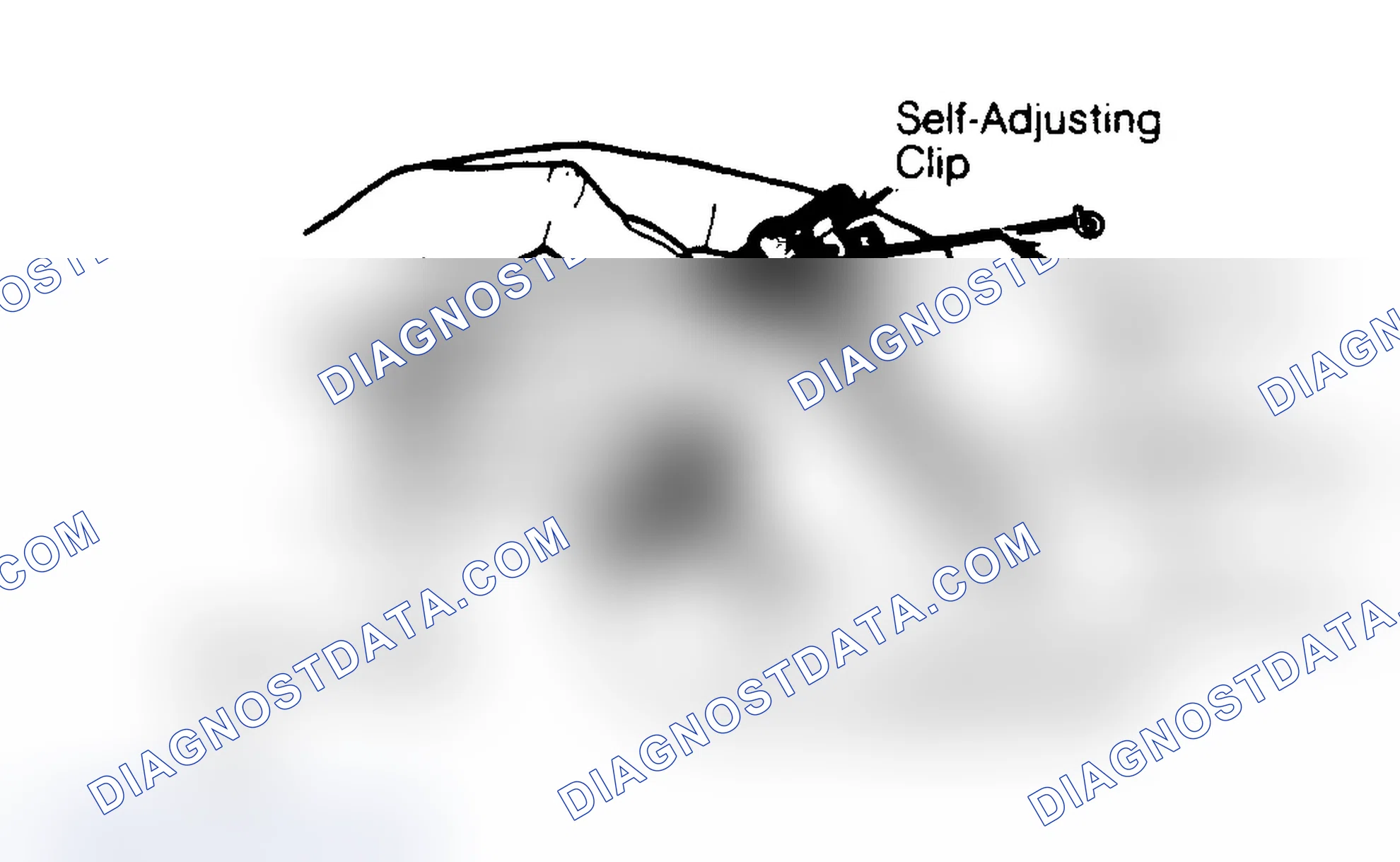 Scheme 4: Self-Adjusting Clip Removal and Installation