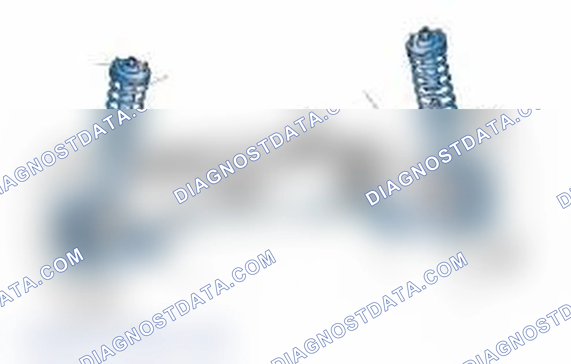 Scheme 25: Typical Front Suspension & Steering Components