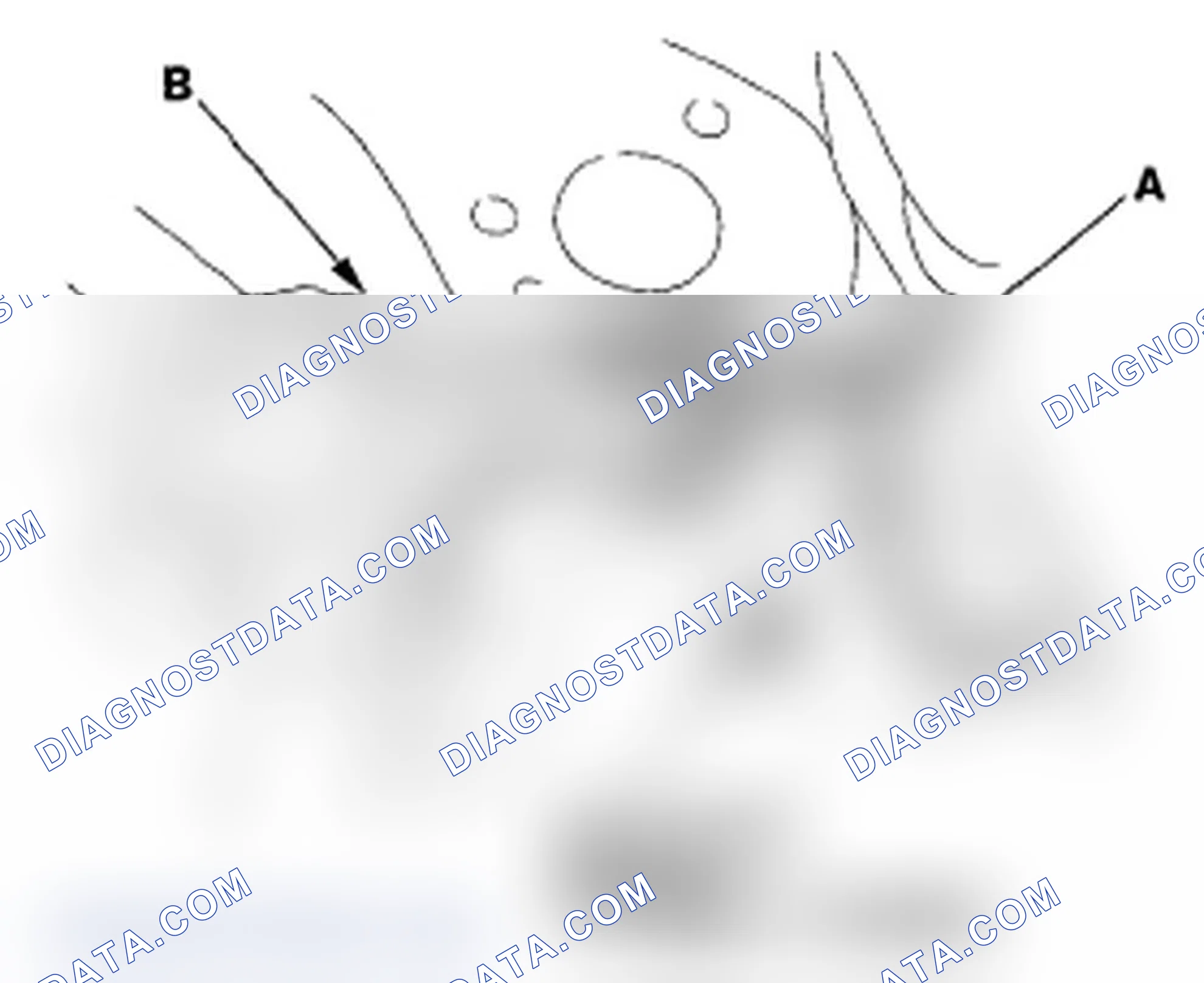 Scheme 19: Upper Arm Replacement