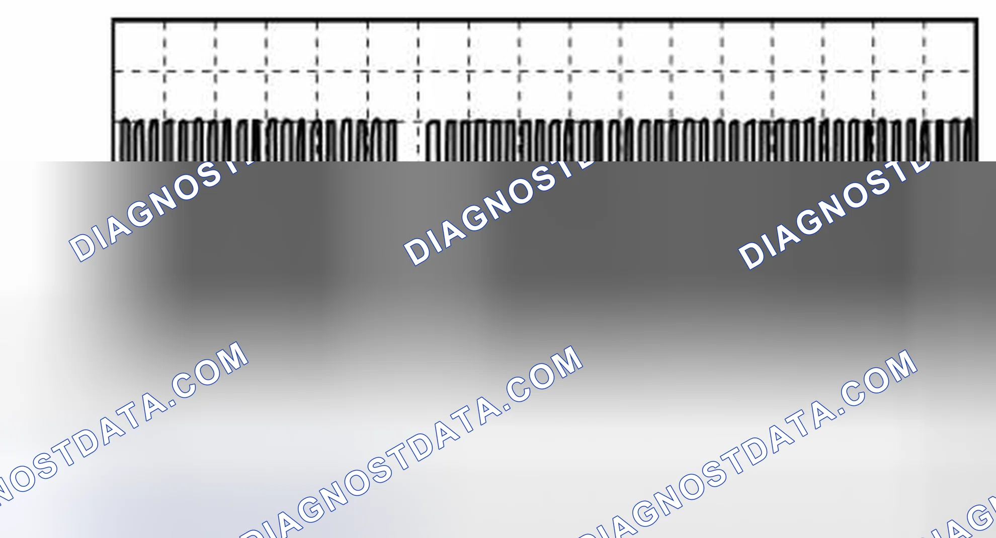 Scheme 140: CKP Sensor Signal Waveform Graph