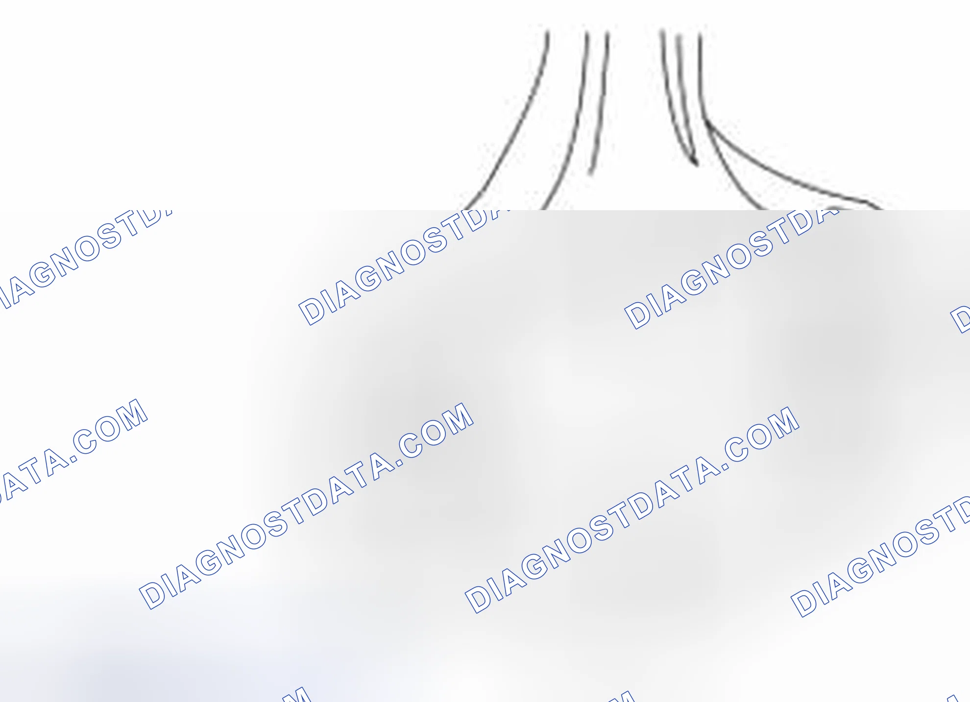 Scheme 2376: Connecting Rod Large End Bore