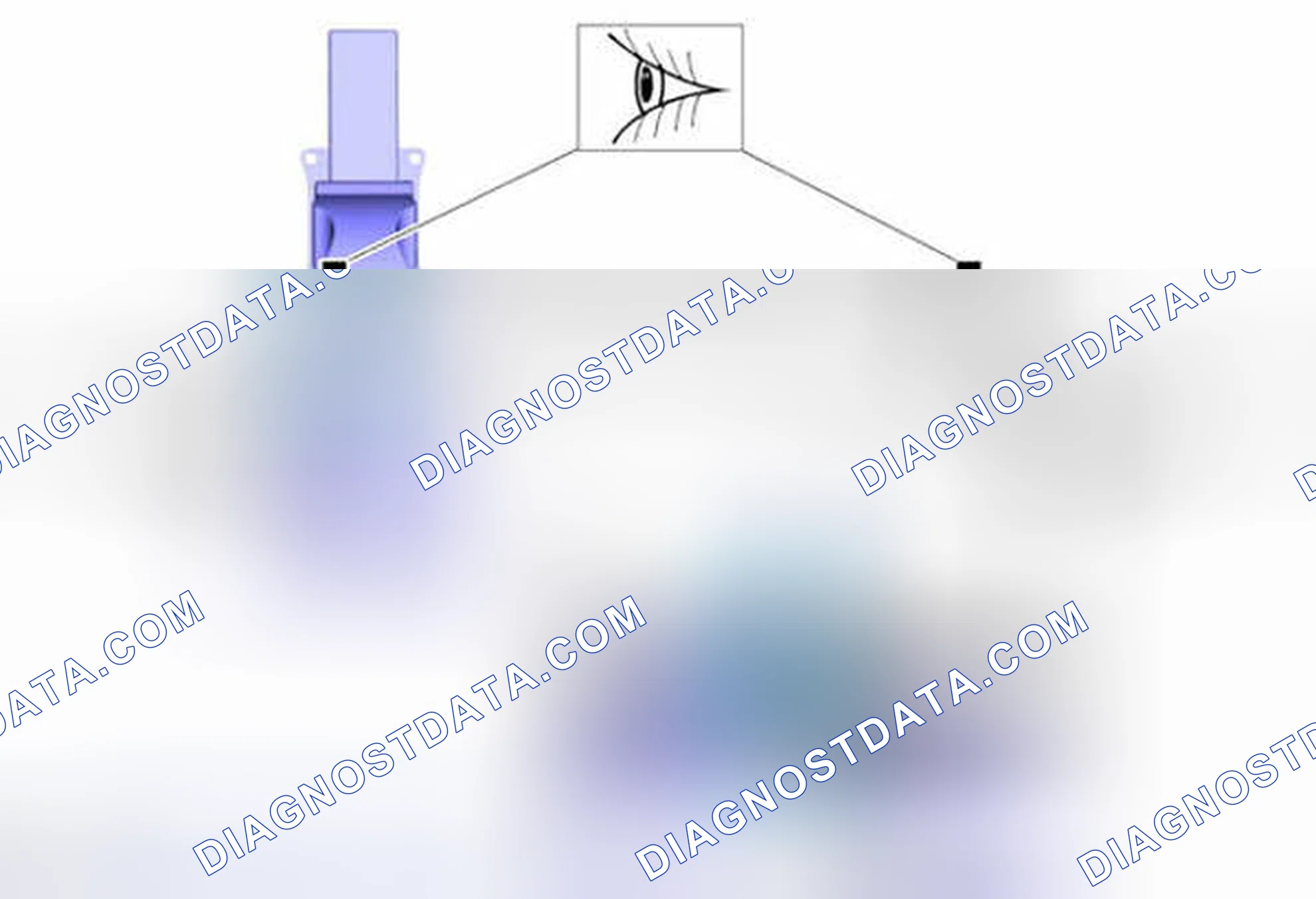 Scheme 5: Installation