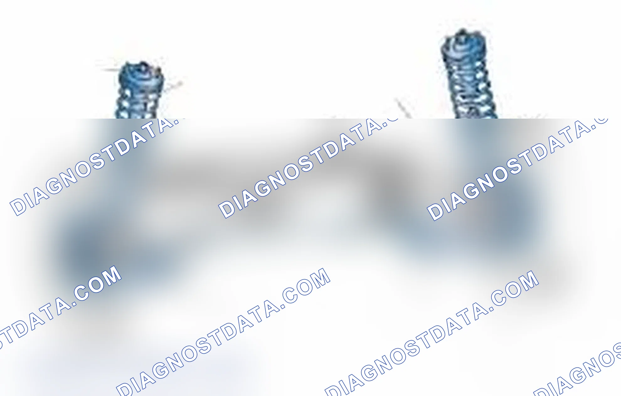 Scheme 25: Typical Front Suspension & Steering Components