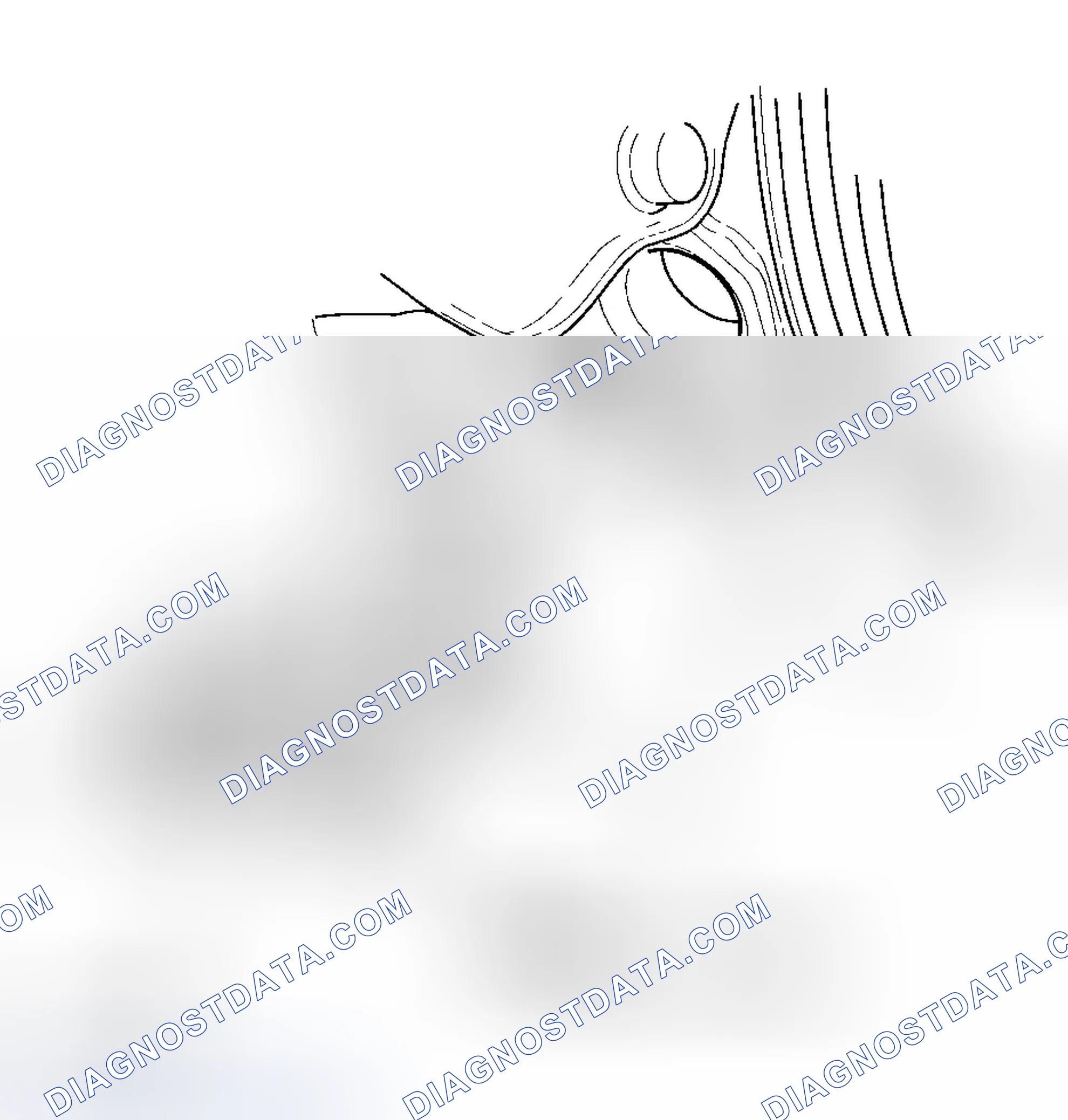 Scheme 171: CKP Sensor Replacement