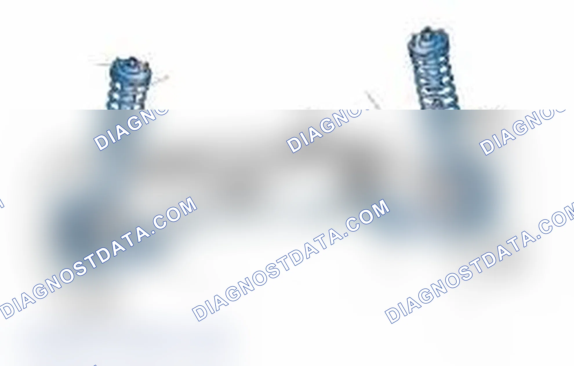 Scheme 25: Typical Front Suspension & Steering Components