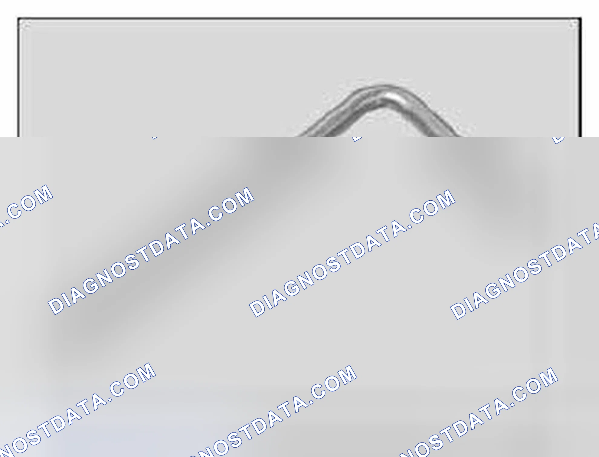 Scheme 774: 11 0 390 Clamping pin