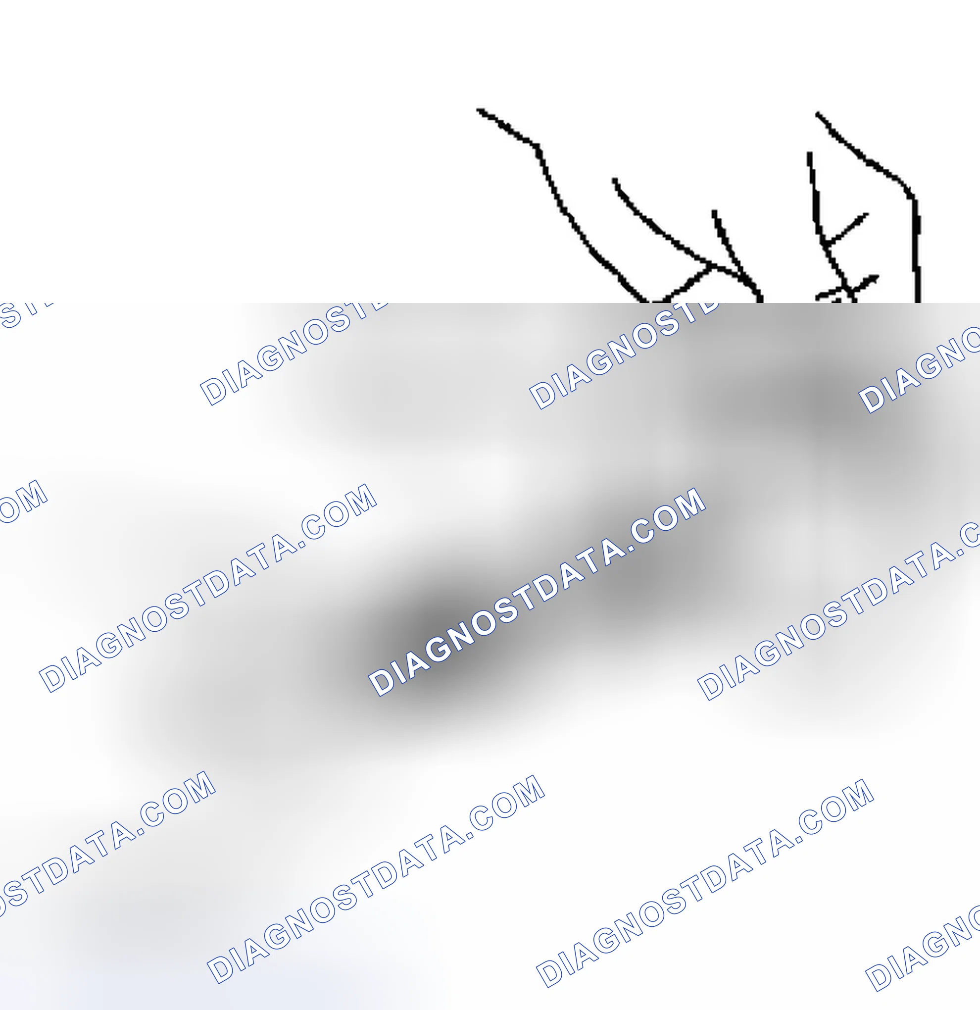 Scheme 231: Piston Pin Outer Diameter