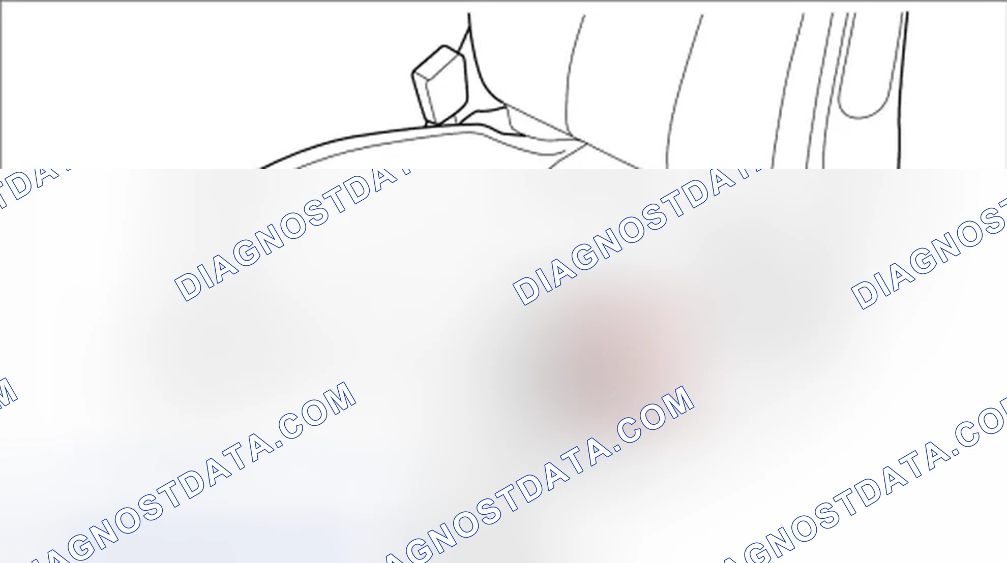 Scheme 25: Removing motor for rear vertical adjustment