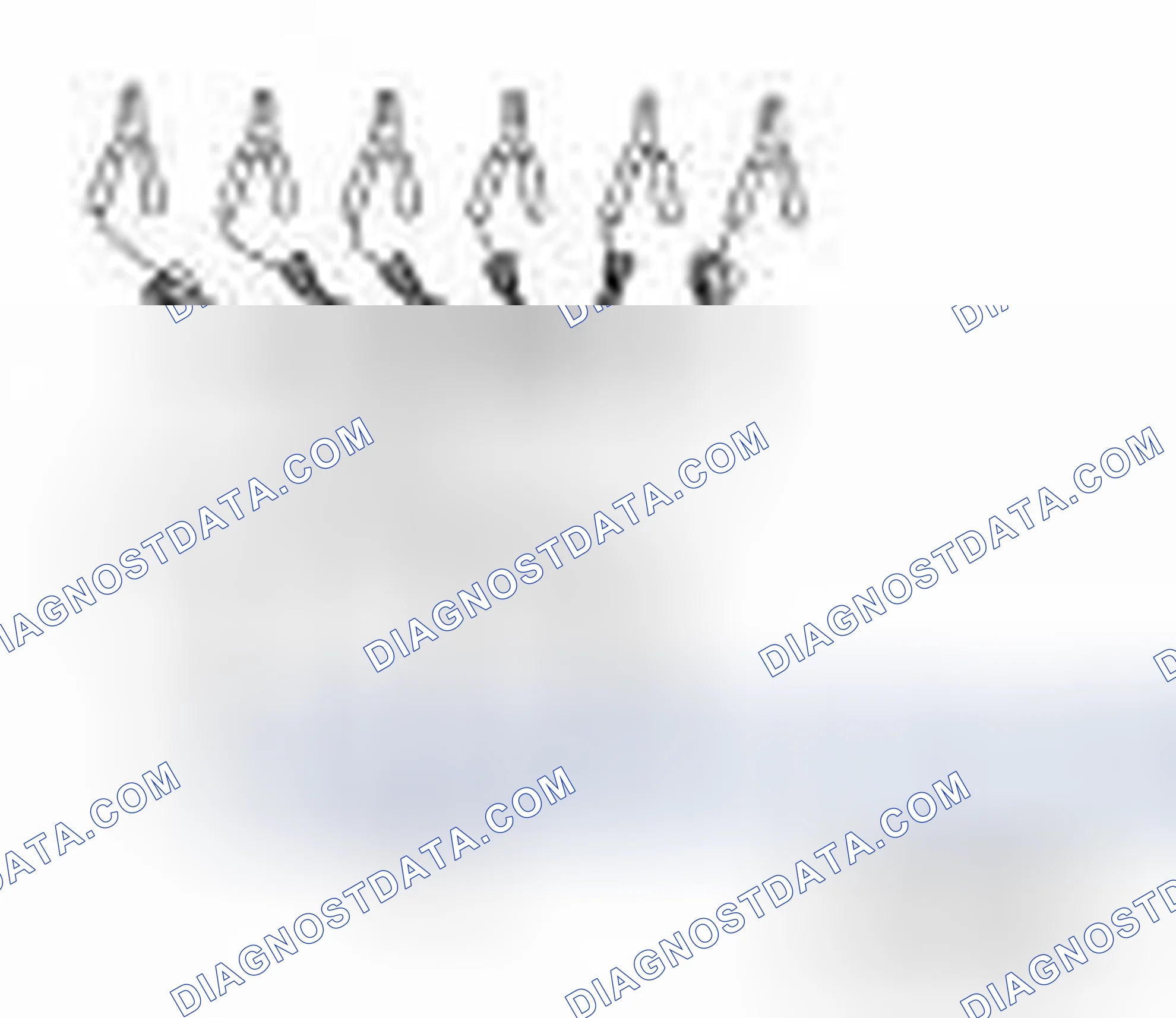 Scheme 70: Special Service Tools