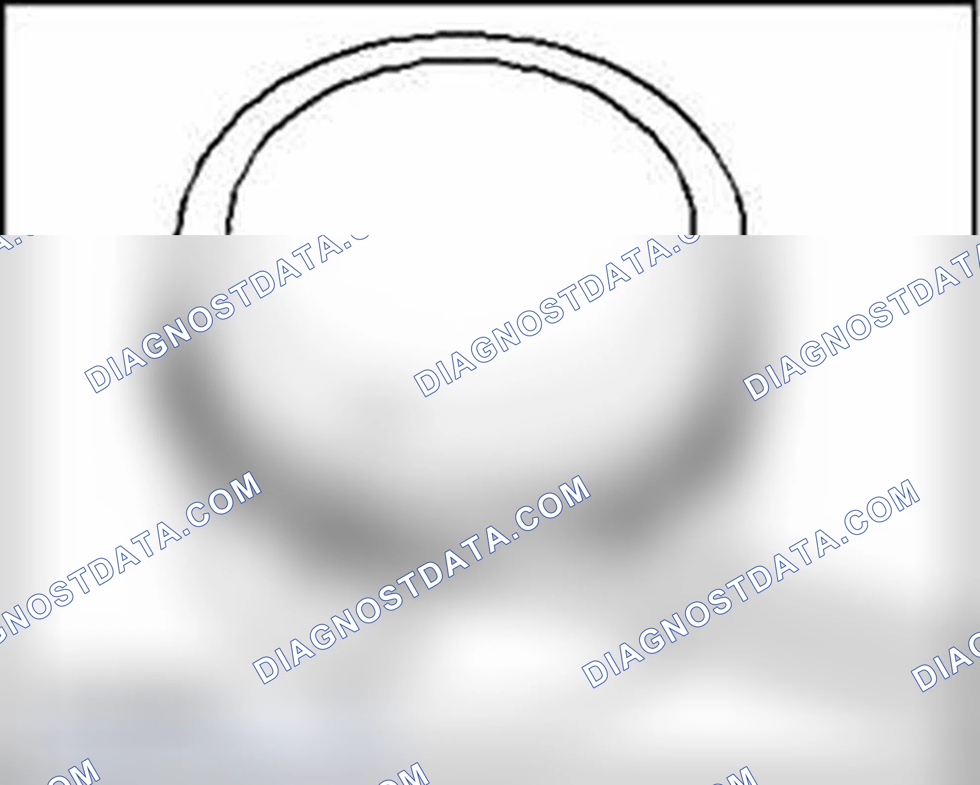 Scheme 176: Checking ring to groove clearance
