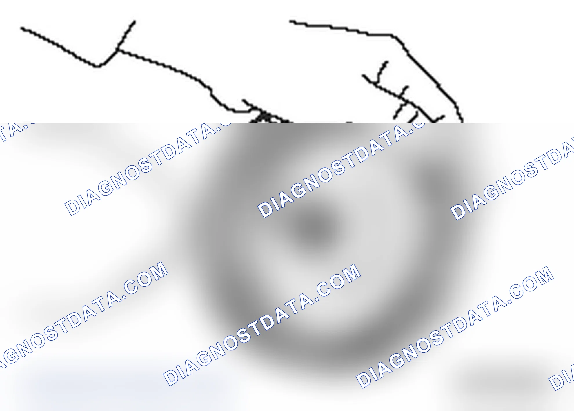 Scheme 252: << C >> SNAP RING REMOVAL