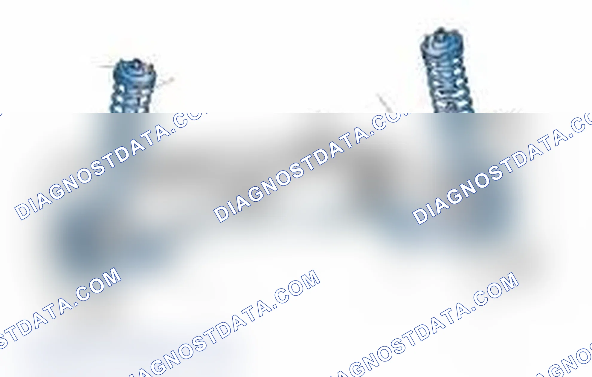 Scheme 25: Typical Front Suspension & Steering Components